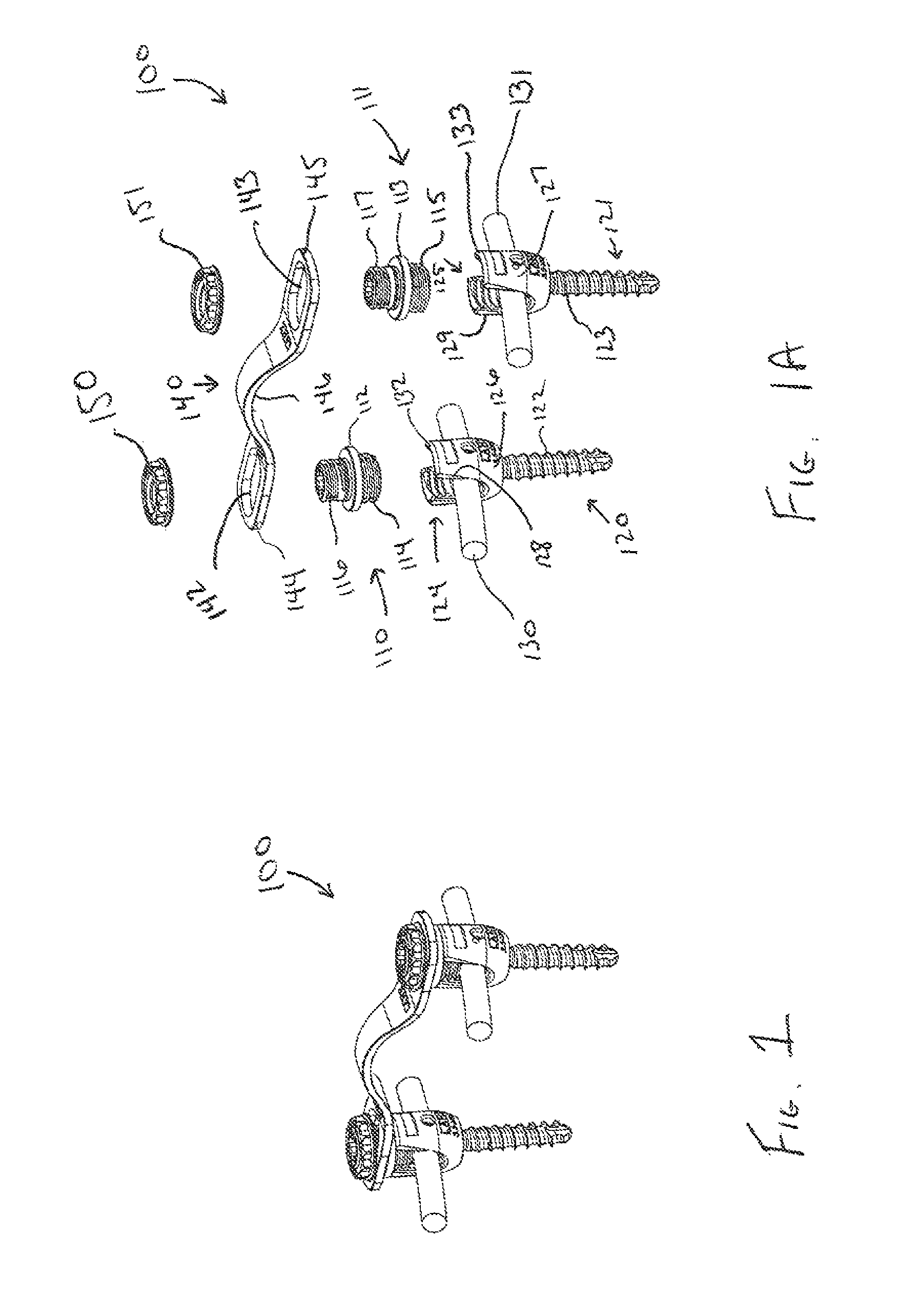 Vertebral fixation system including torque mitigation