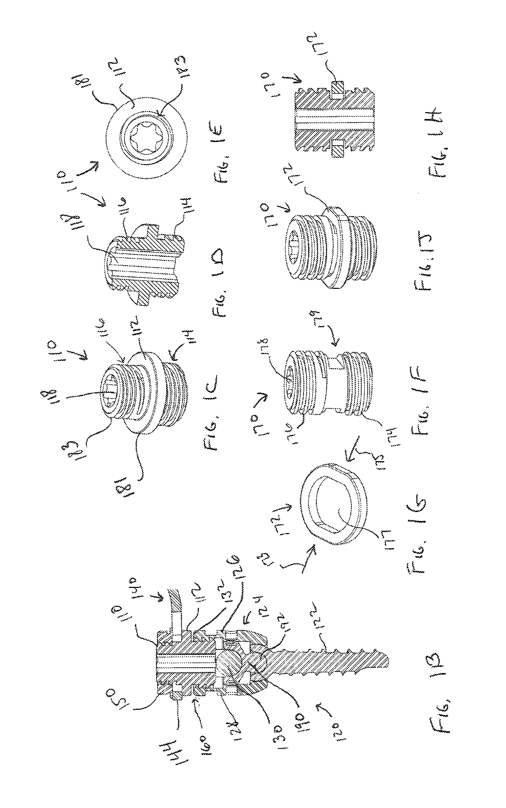 Vertebral fixation system including torque mitigation