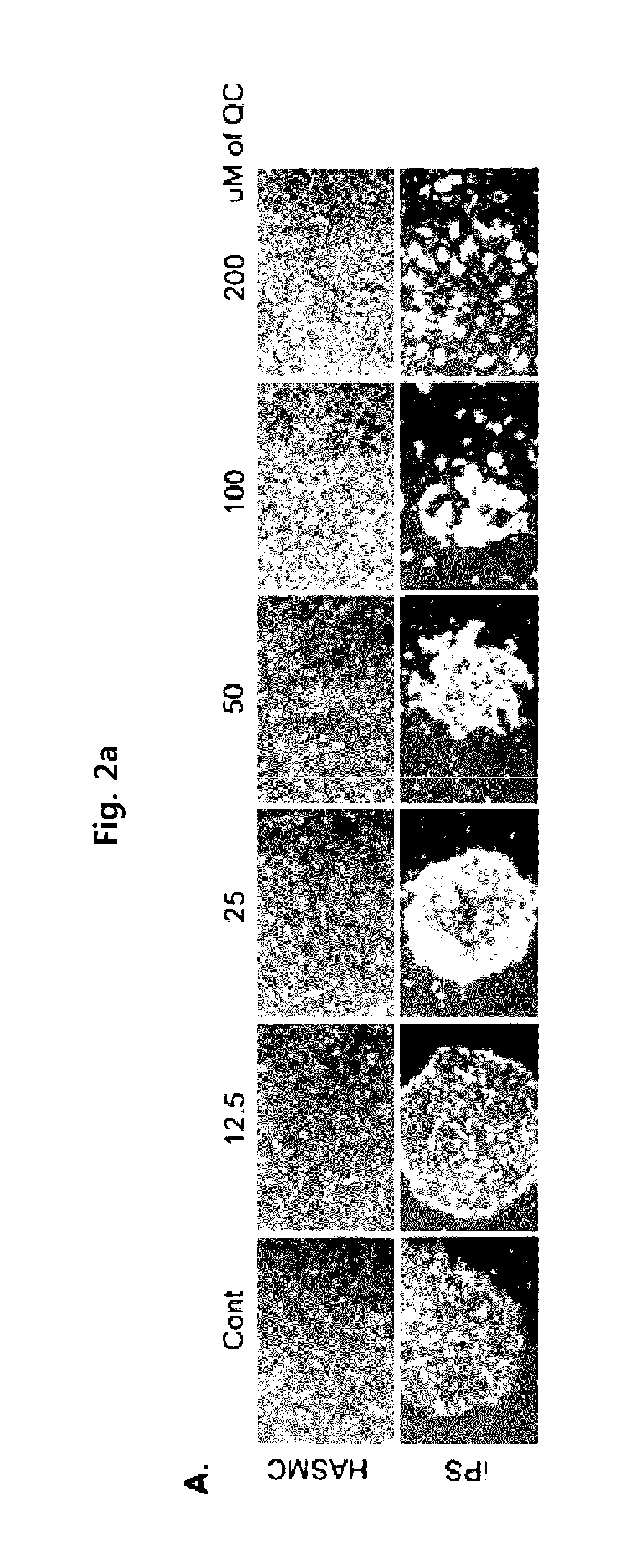 Method for suppressing teratoma formation via selective cell death induction in undifferentiated human-induced pluripotent stem cells