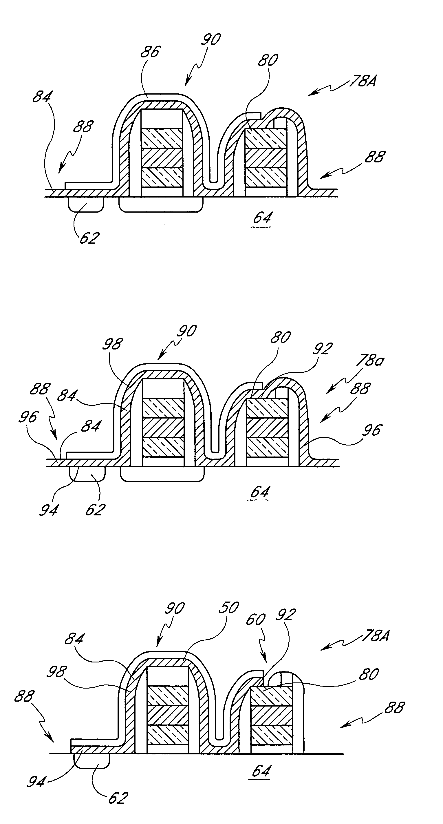 Transistor gate and local interconnect