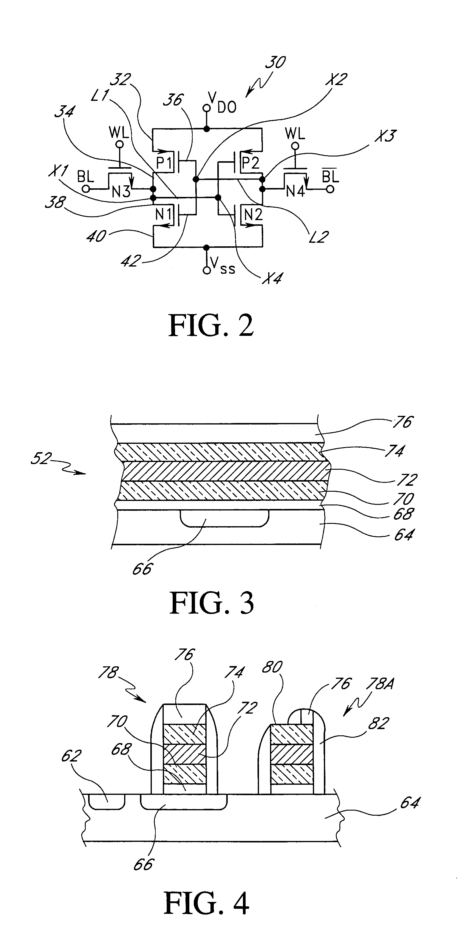 Transistor gate and local interconnect