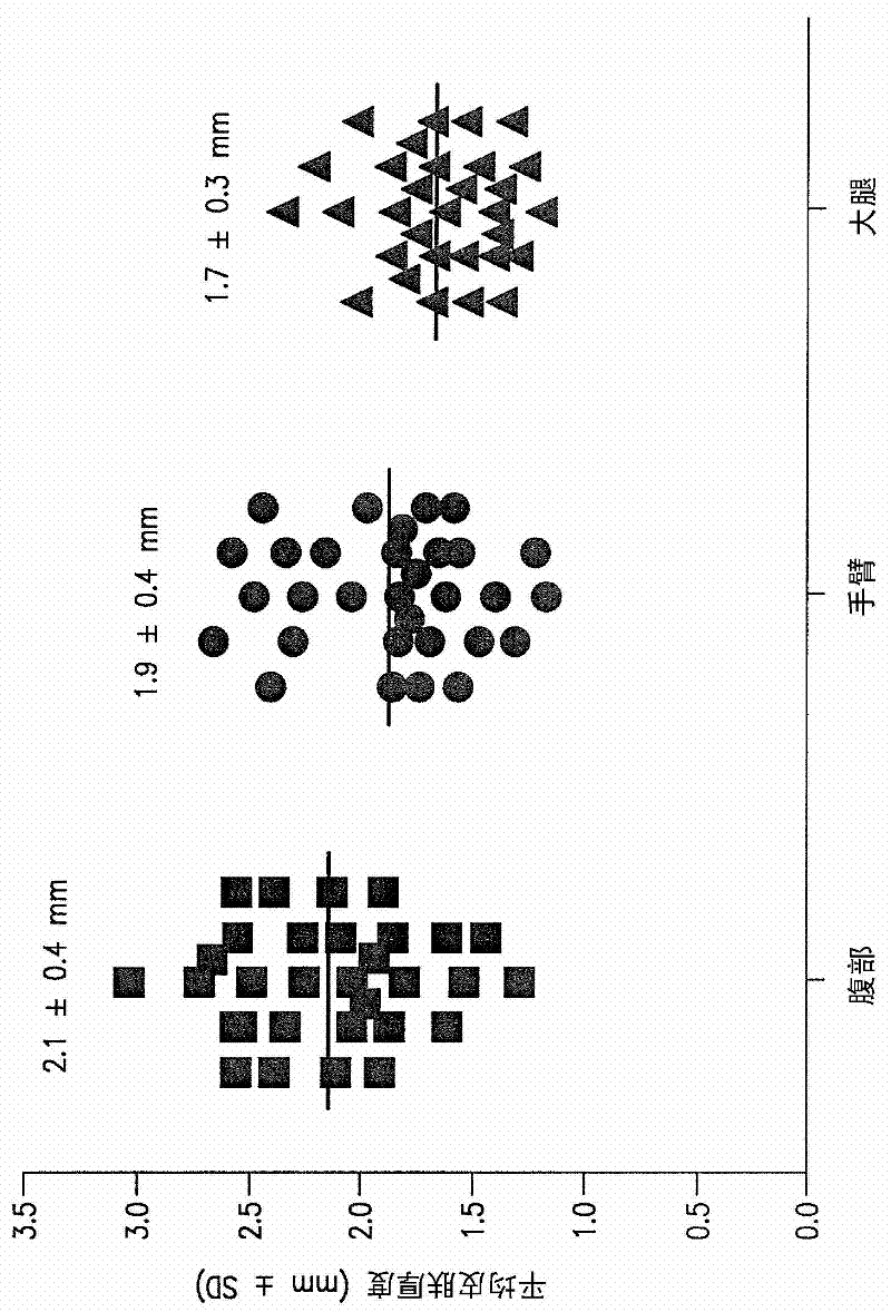 Device and methods for subcutaneous delivery of high viscosity fluids