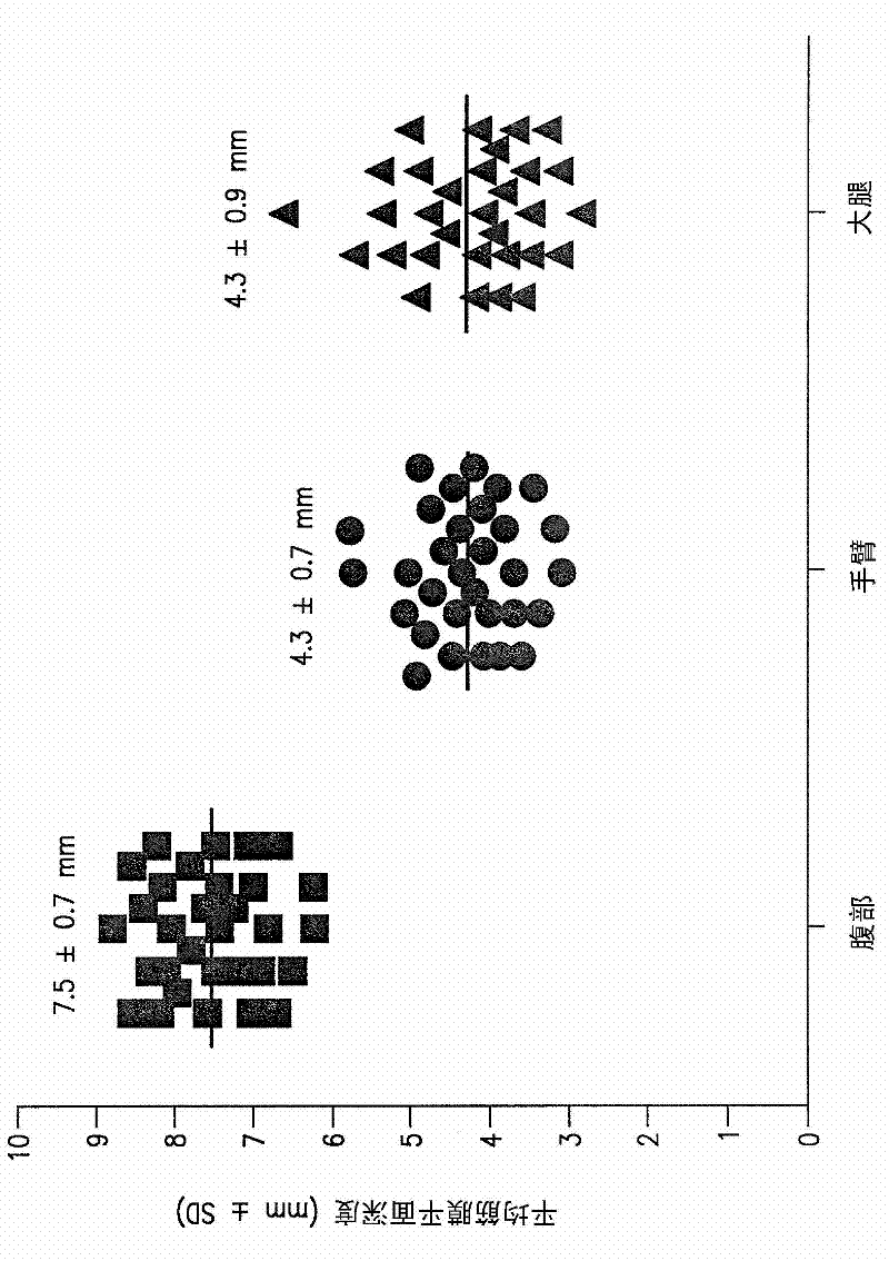 Device and methods for subcutaneous delivery of high viscosity fluids