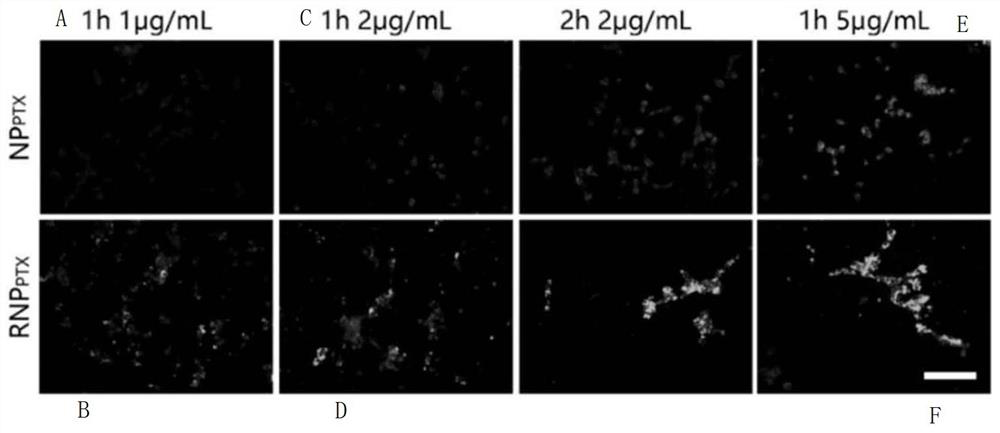 Cerebral glioma drug delivery system integrating three-in-one of chemotherapy, photodynamic therapy and chemodynamic therapy and preparation method of cerebral glioma drug delivery system