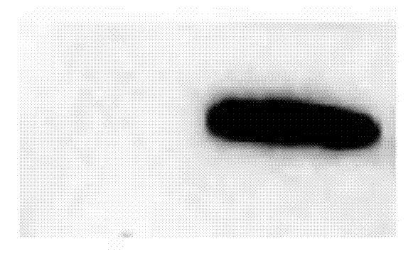 Cecropins obtained from Aedes aegypti, coding gene and applications thereof