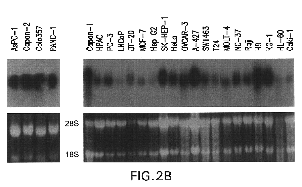 Methods and compositions for diagnosis and treatment of cancer