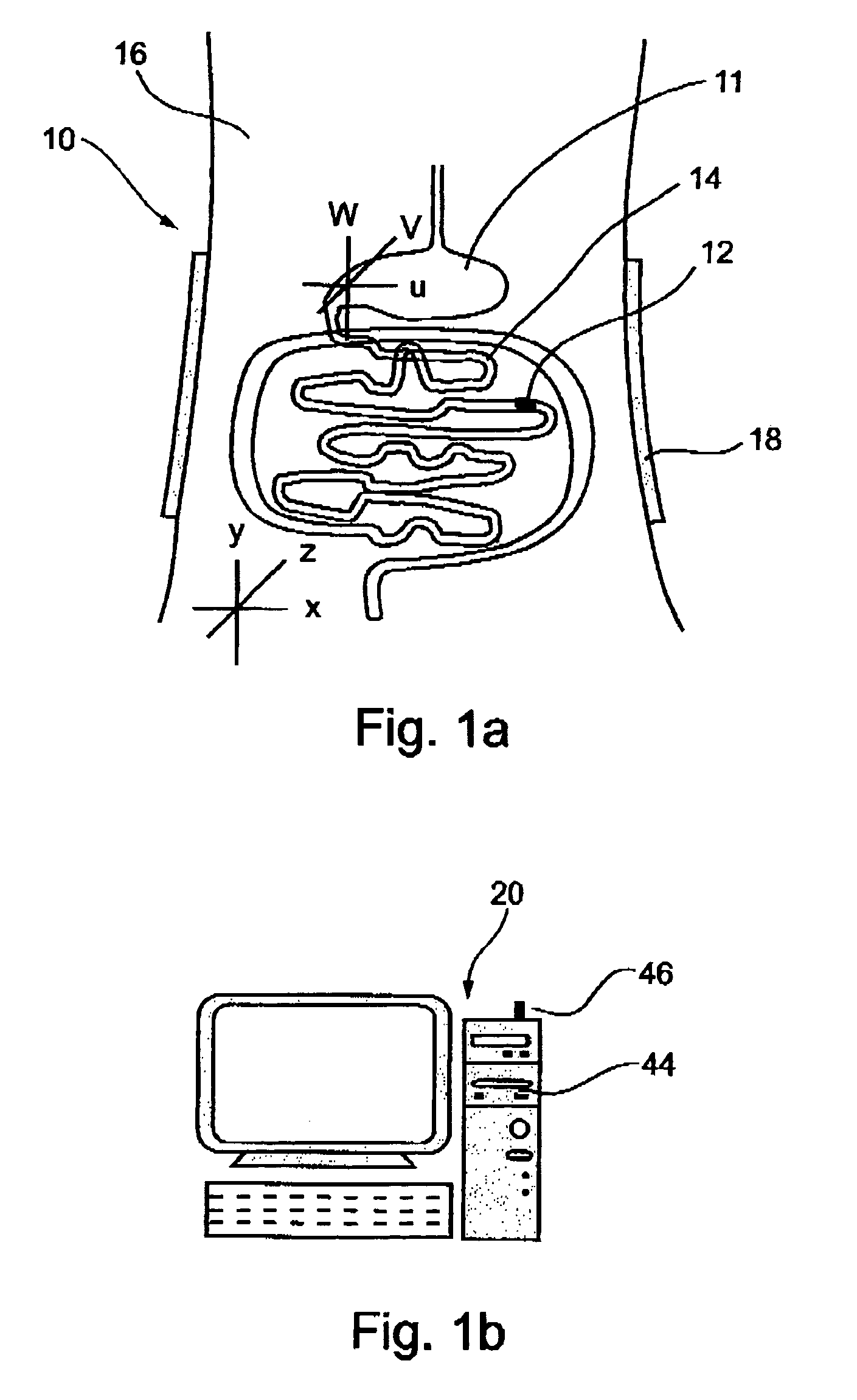 Ingestible pill for diagnosing a gastrointestinal tract