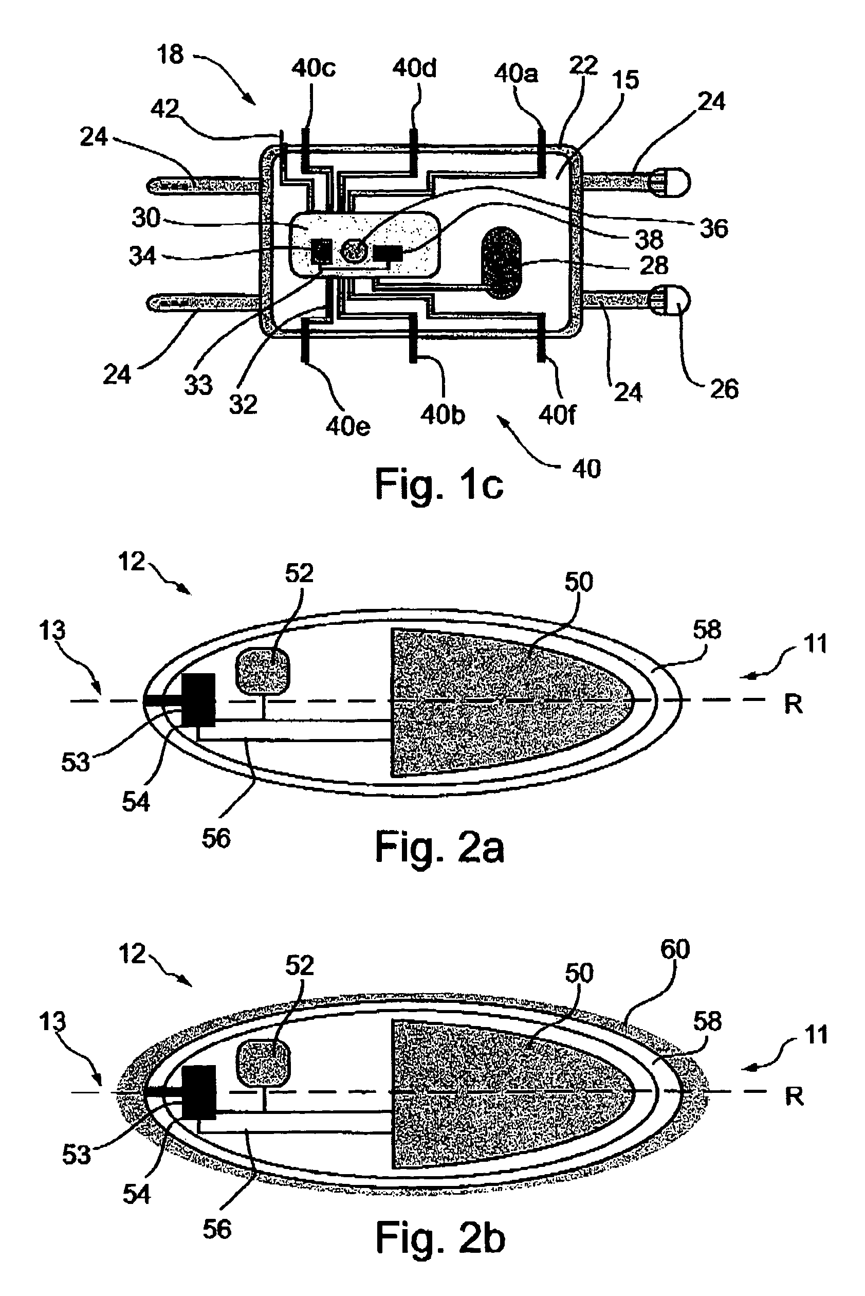 Ingestible pill for diagnosing a gastrointestinal tract