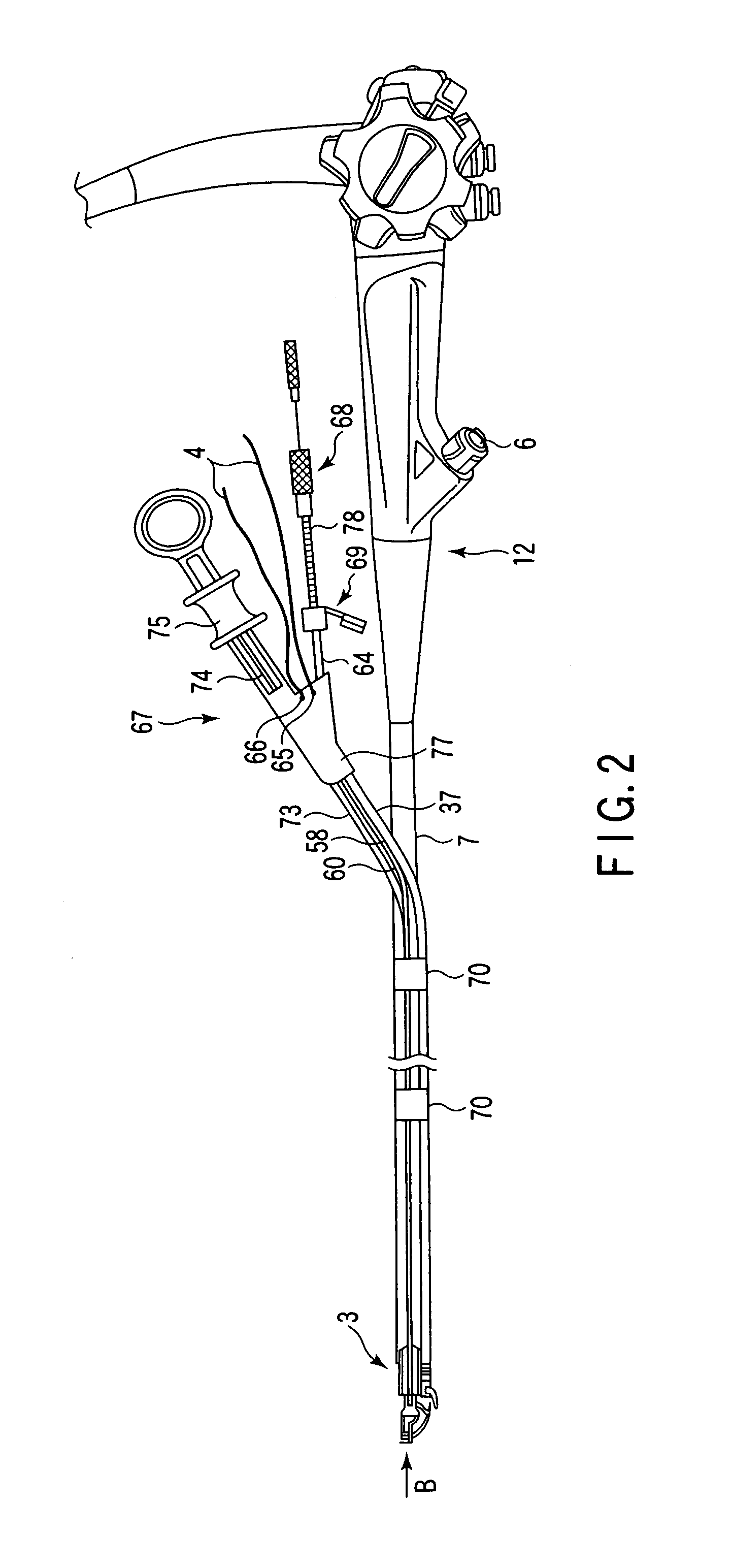 Endoscopic suturing system