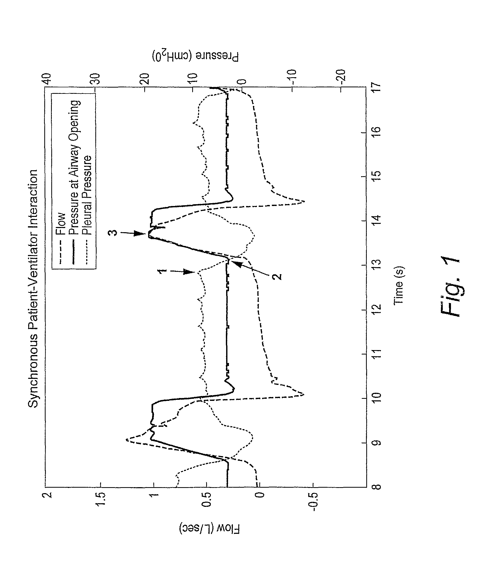 Method and apparatus for detecting ineffective inspiratory efforts and improving patient-ventilator interaction