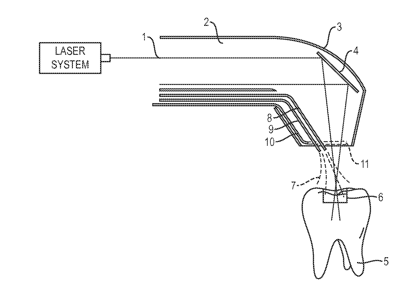 Apparatus and method for controlled fluid cooling during laser based dental treatments