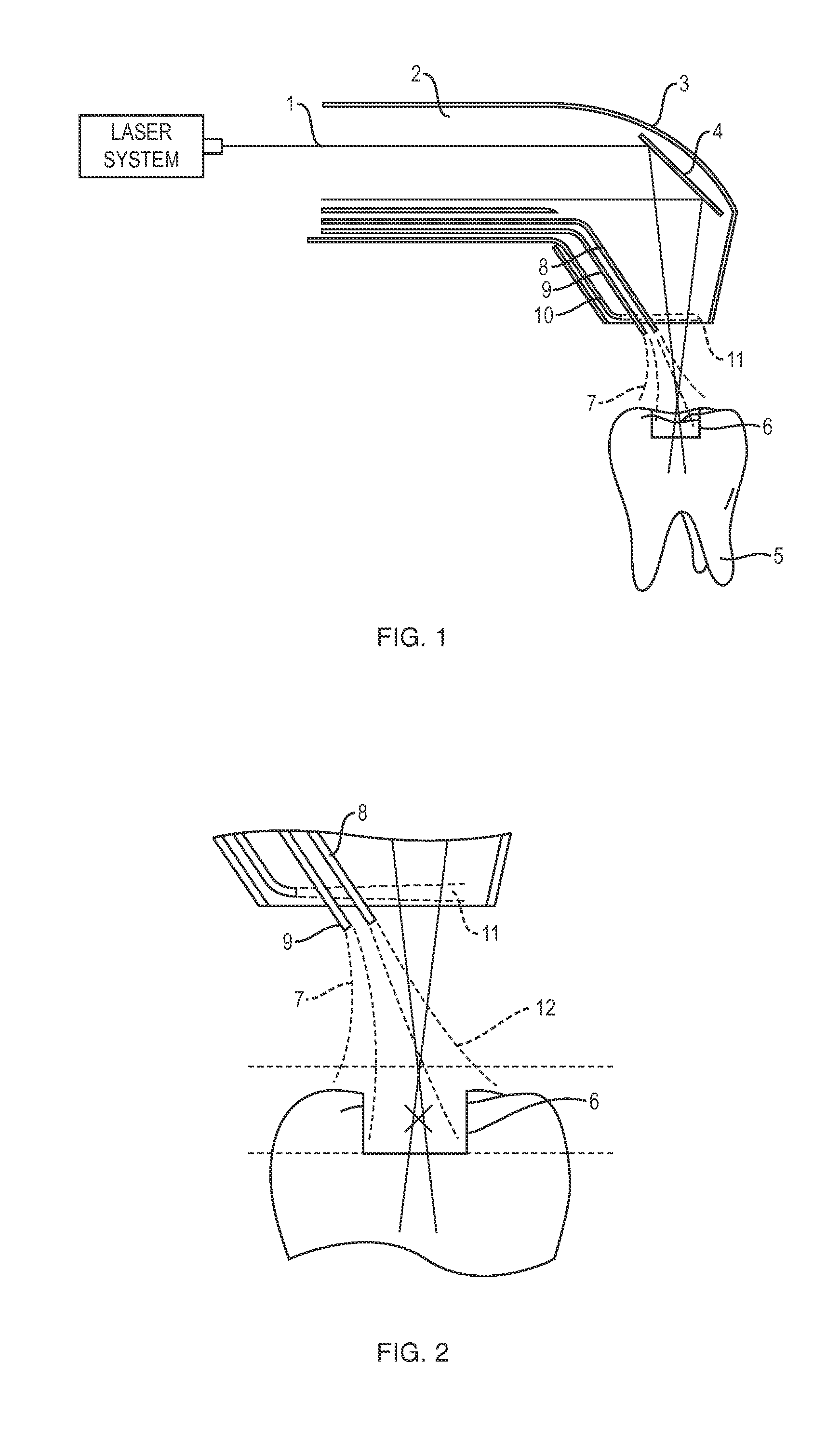 Apparatus and method for controlled fluid cooling during laser based dental treatments