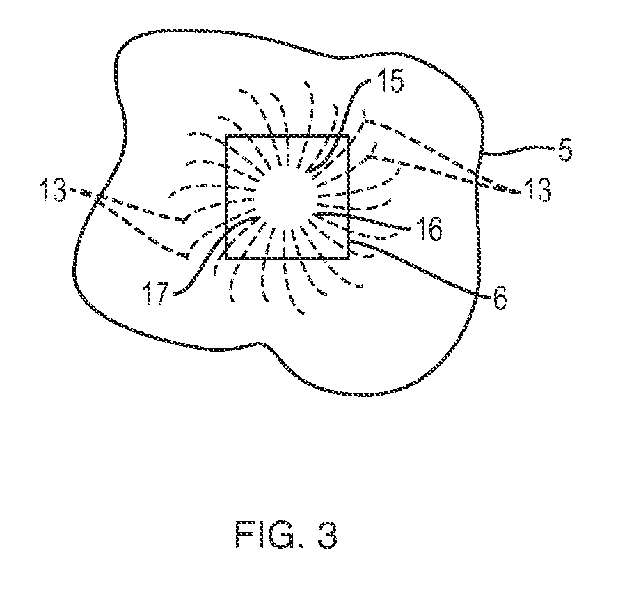 Apparatus and method for controlled fluid cooling during laser based dental treatments