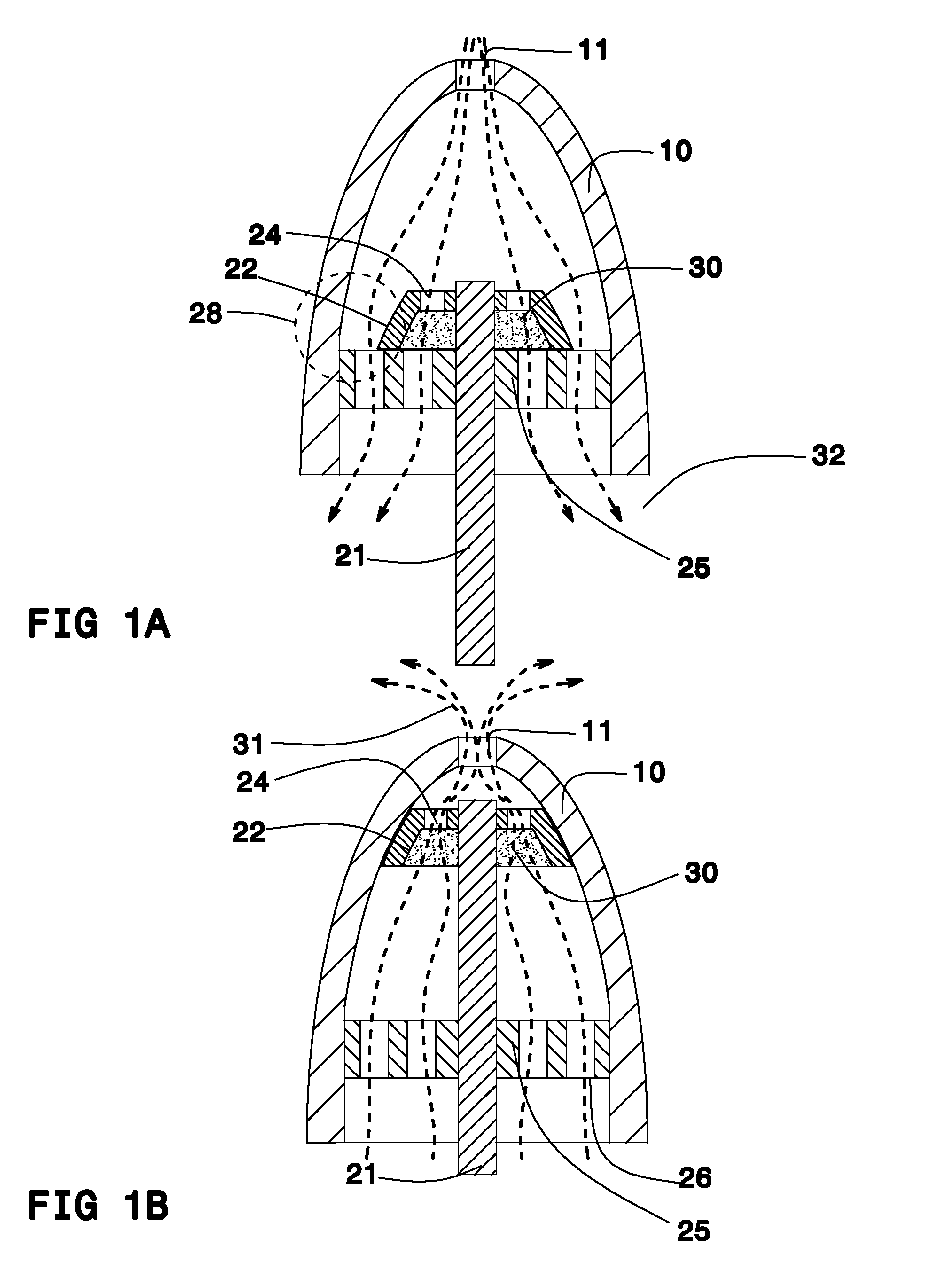 Nose filter