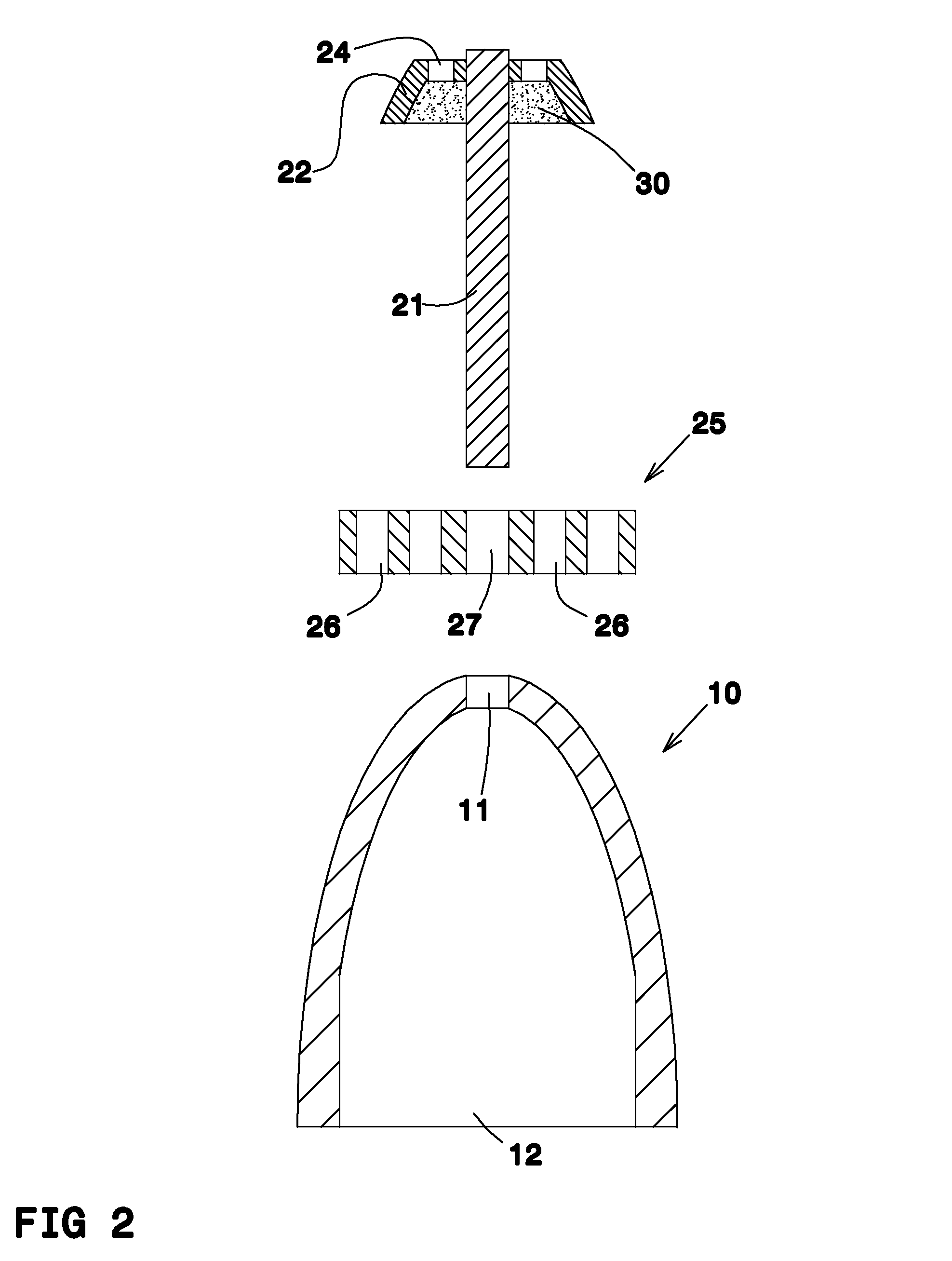 Nose filter