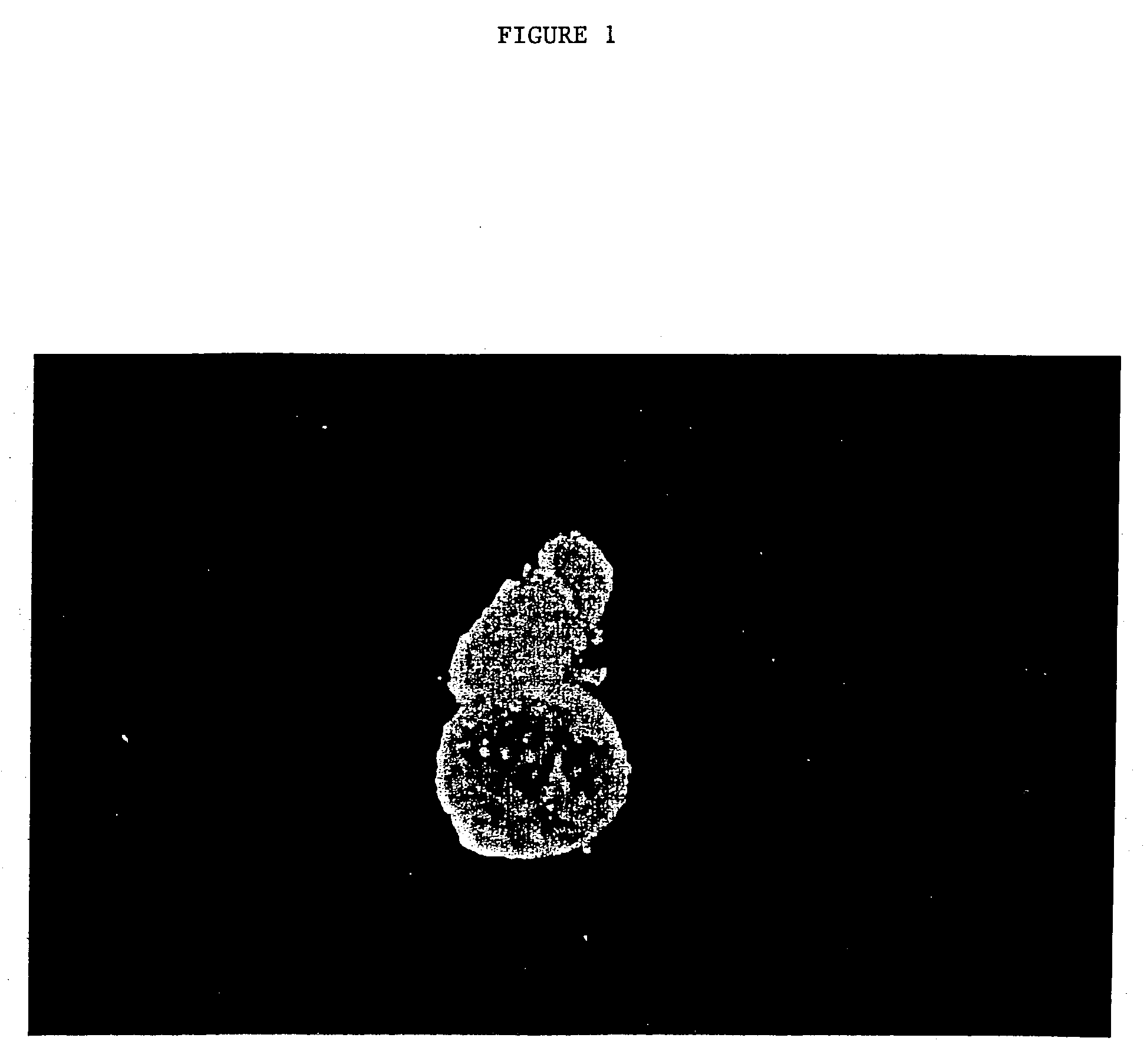 Gynogenetic or androgenetic production of pluripotent cells and cell lines, and use thereof to produce differentiated cells and tissues