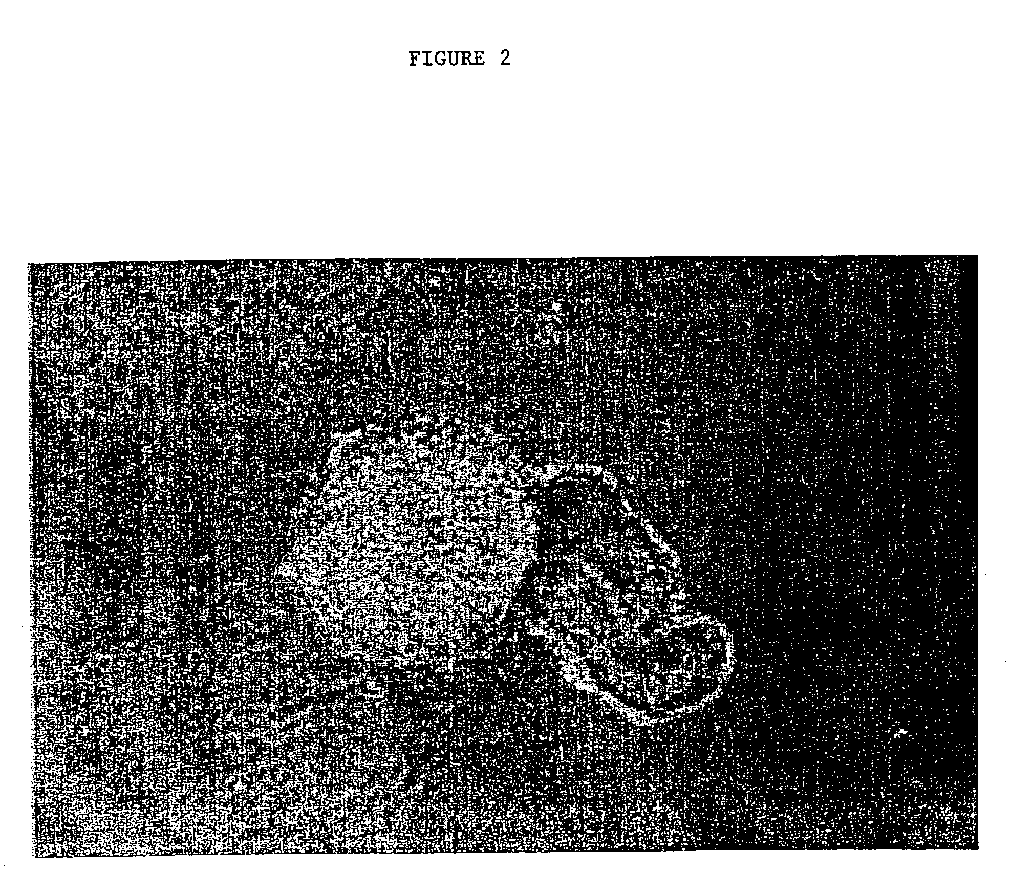 Gynogenetic or androgenetic production of pluripotent cells and cell lines, and use thereof to produce differentiated cells and tissues