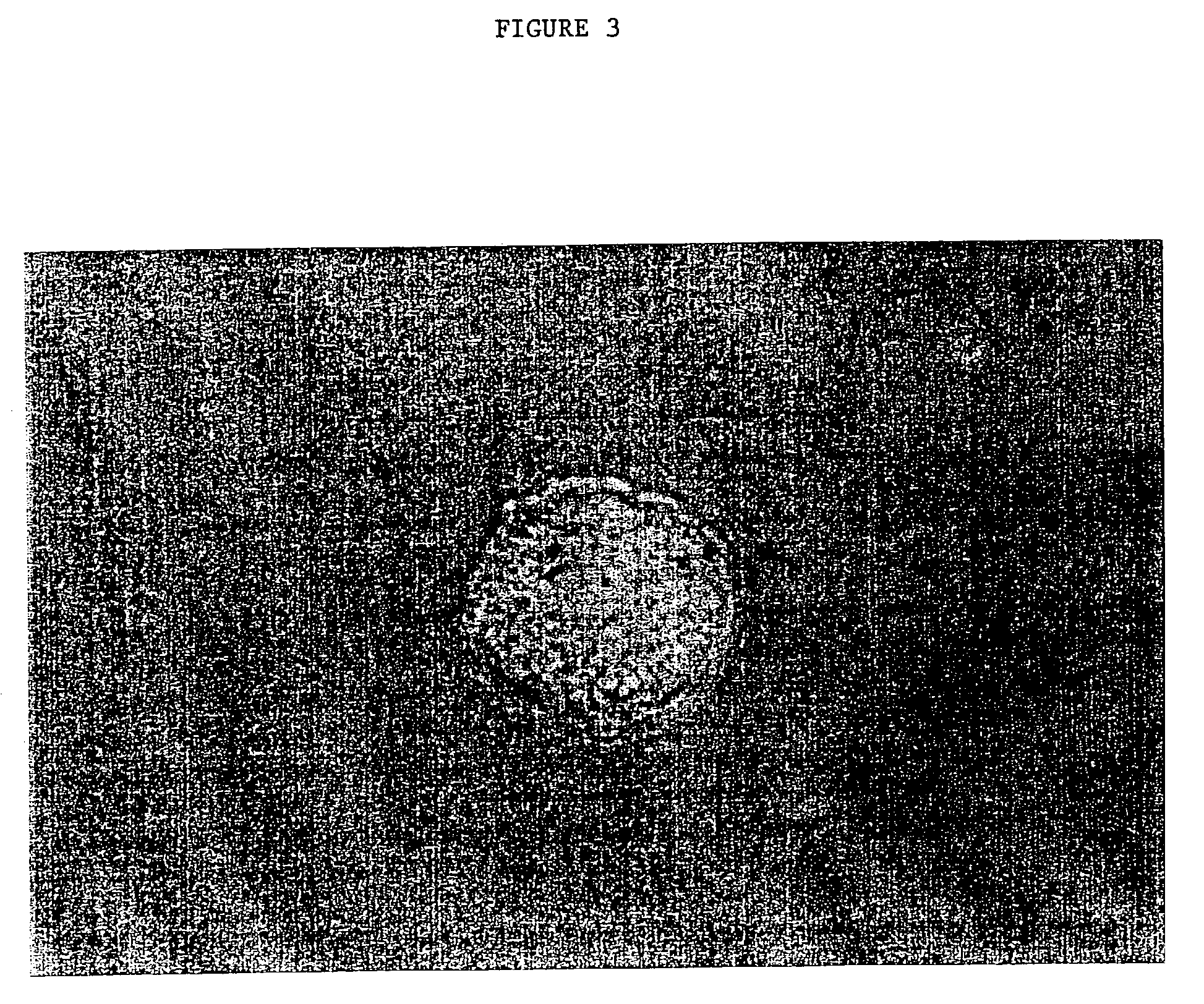 Gynogenetic or androgenetic production of pluripotent cells and cell lines, and use thereof to produce differentiated cells and tissues