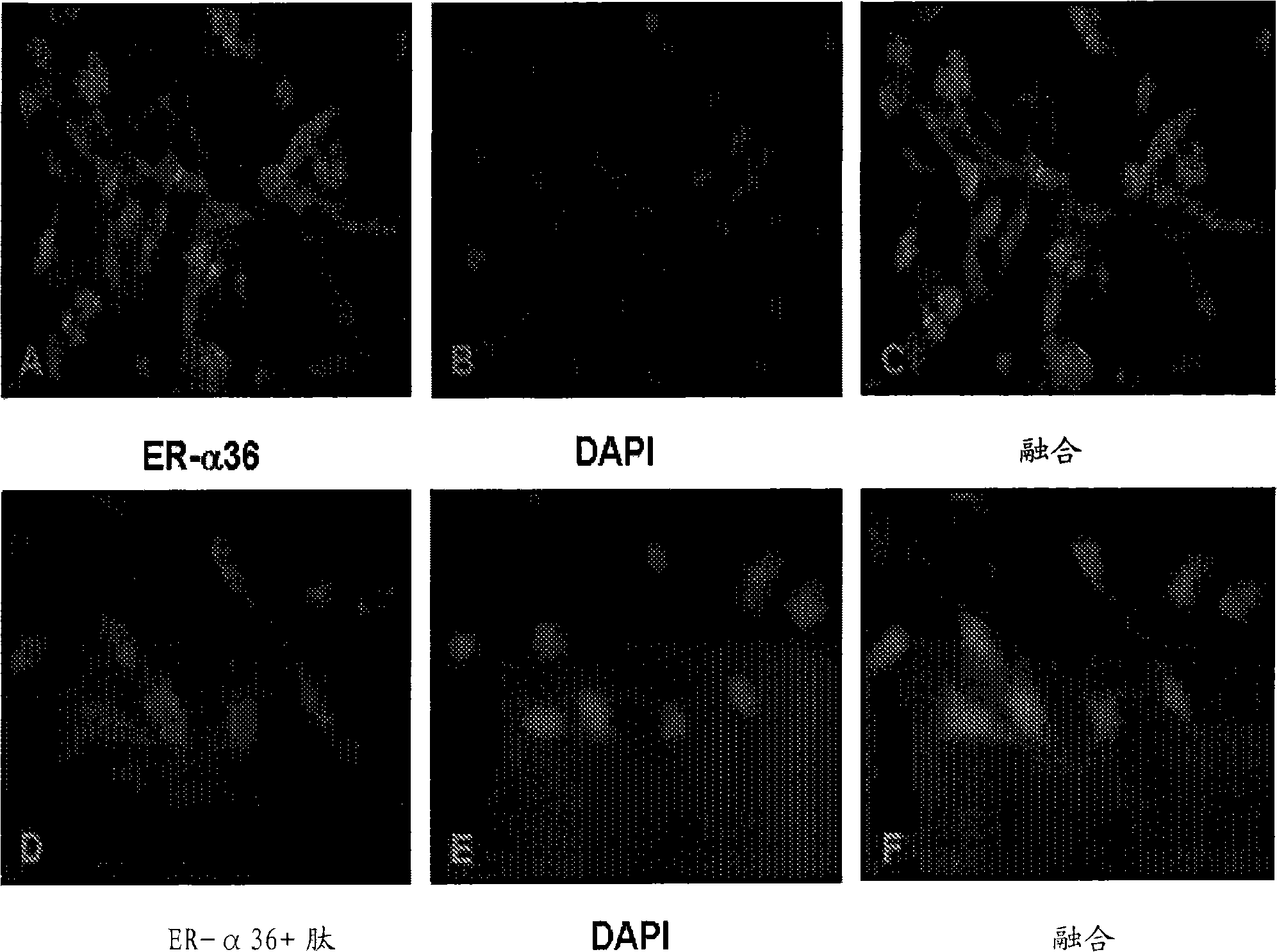 Compounds and methods for treating estrogen receptor-related diseases