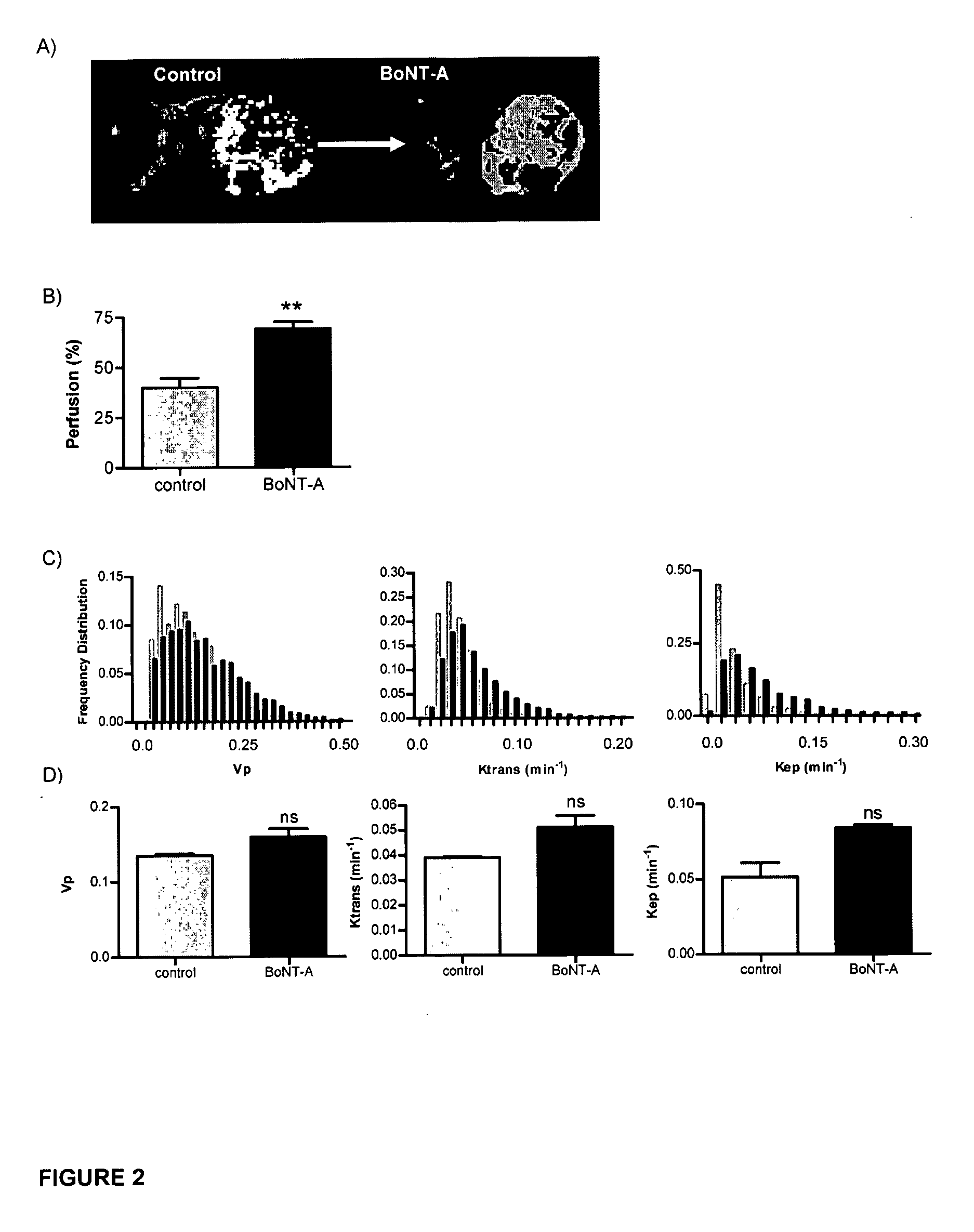 Methods and compositions for the treatment of cancer