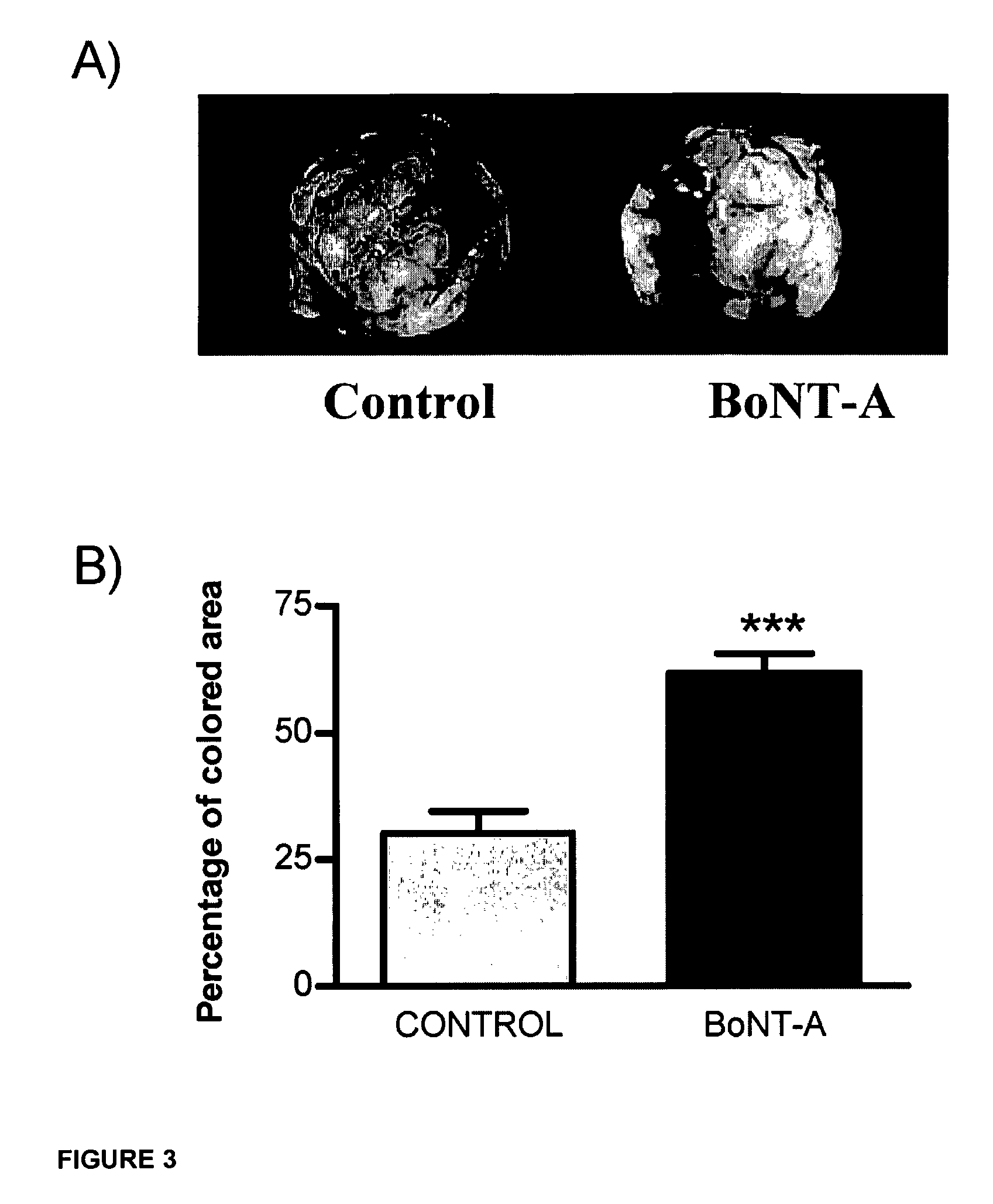 Methods and compositions for the treatment of cancer