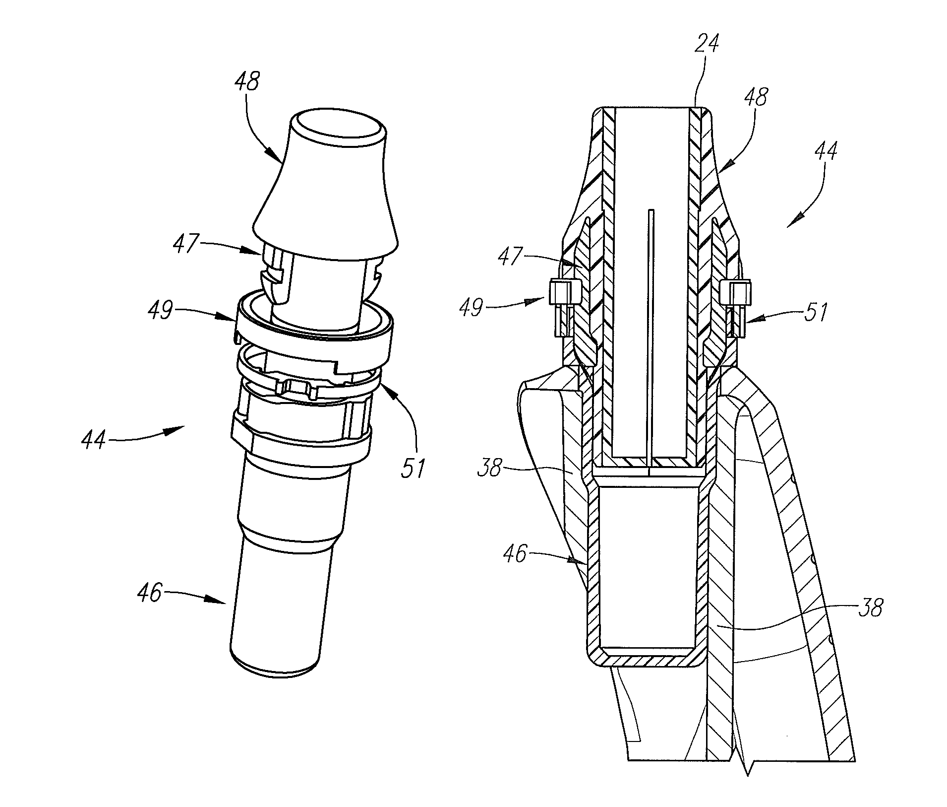 Connection assembly for a golf club