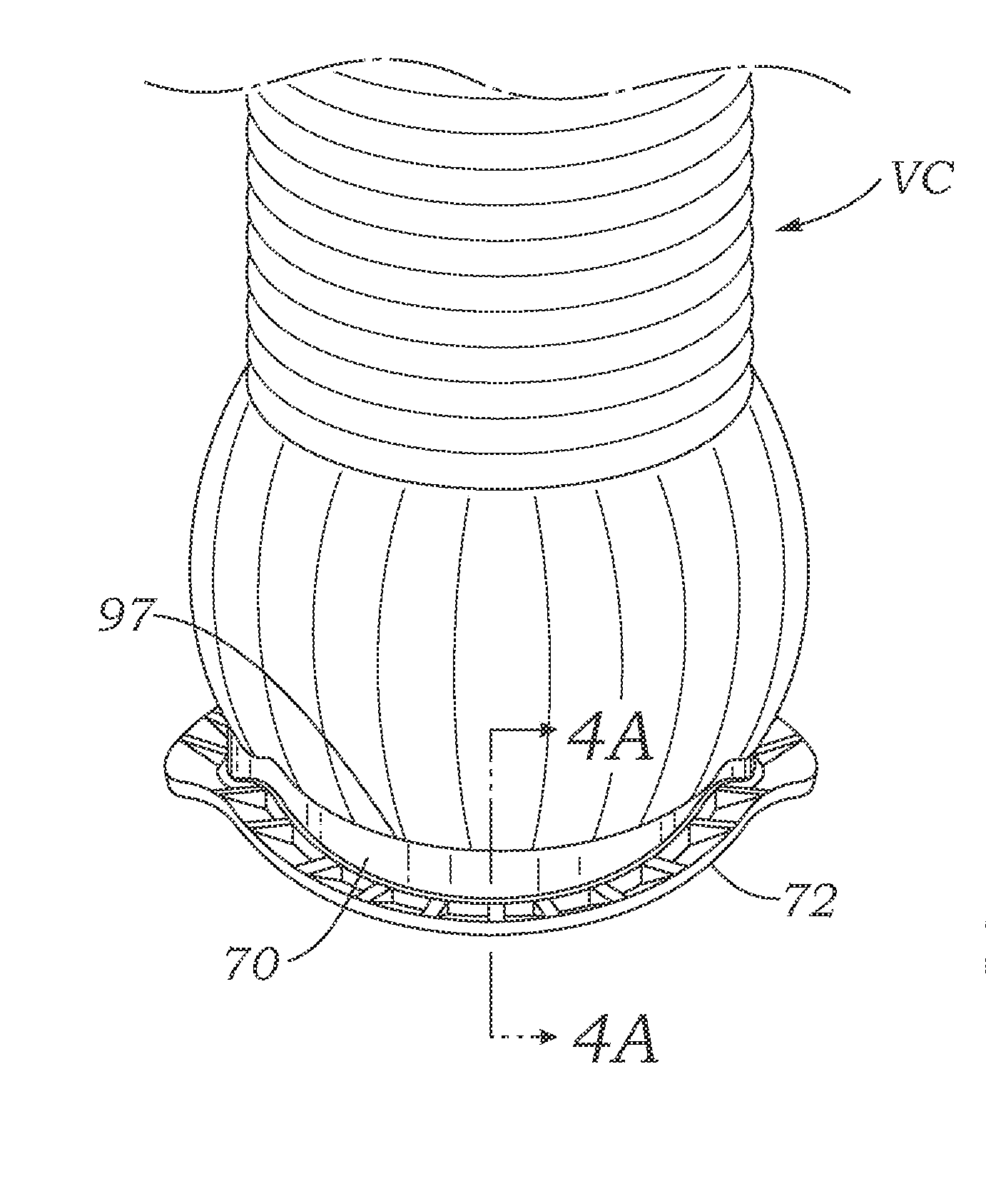 Valved aortic conduits