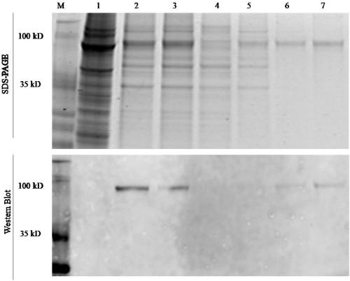 Soluble CD105 protein eukaryotic expression and purification method