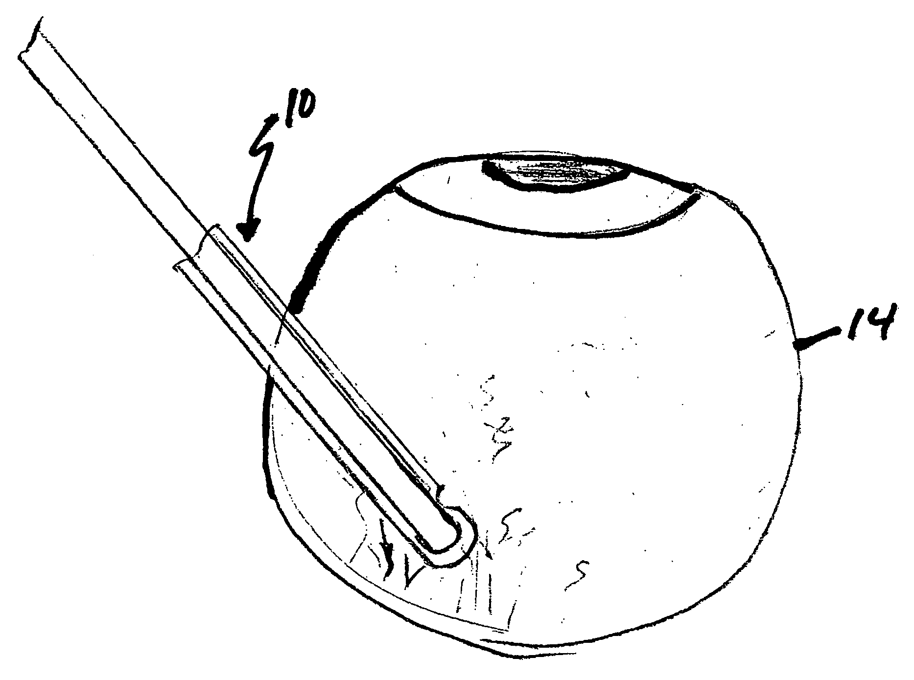 Tubular microsurgery cutting apparatus and method