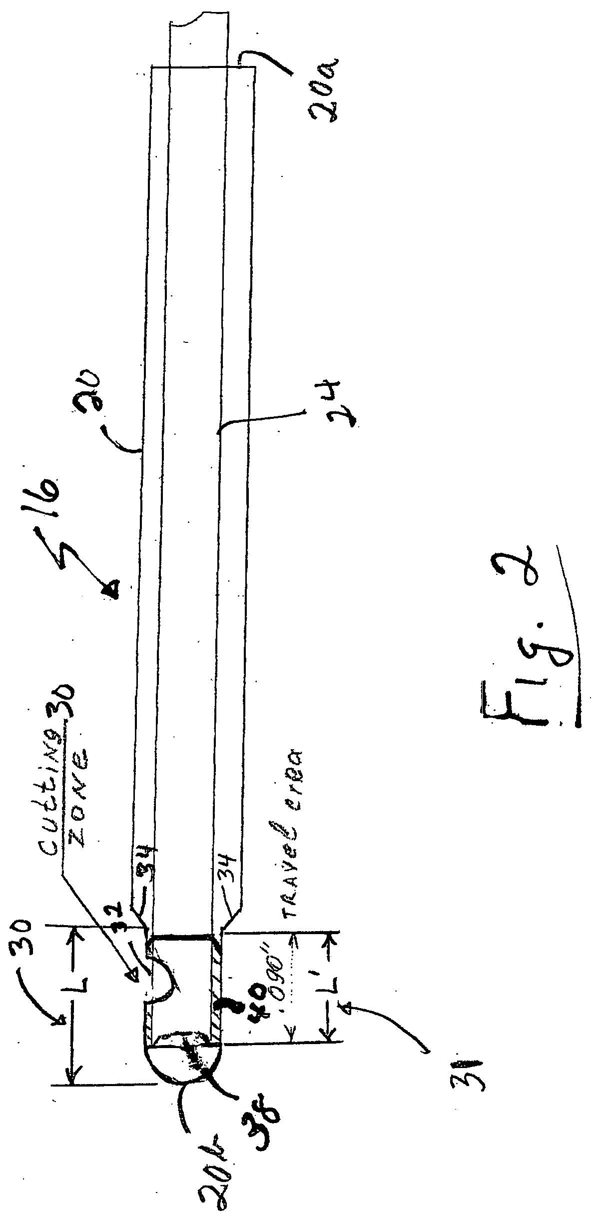 Tubular microsurgery cutting apparatus and method