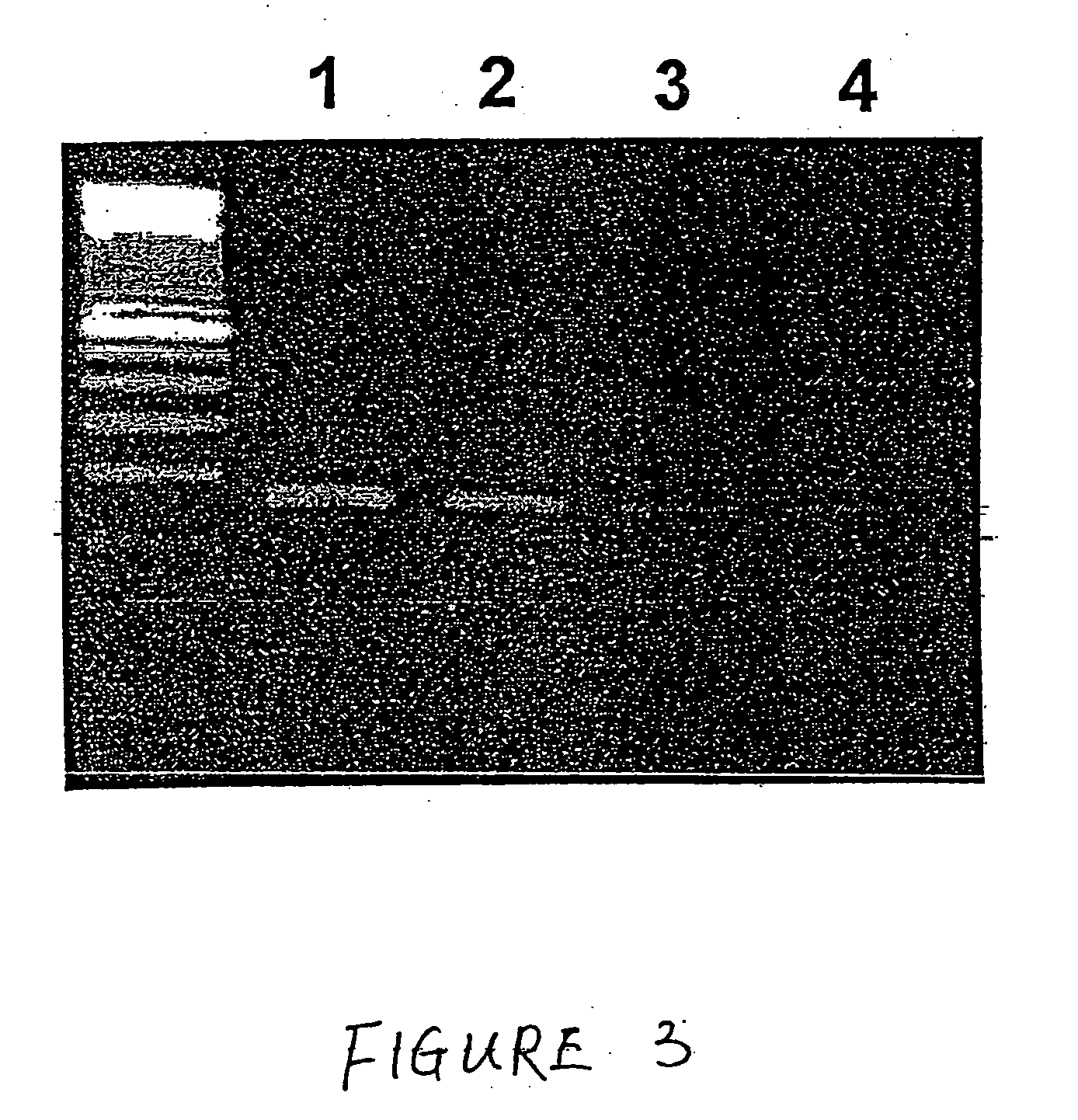 Method for the detection of rheumatoid arthritis related gene transcripts in blood