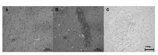 Application of lychee seed flavonoids compounds in terms of preparation of medicine for treating herpes simplex virus encephalitis