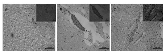 Application of lychee seed flavonoids compounds in terms of preparation of medicine for treating herpes simplex virus encephalitis