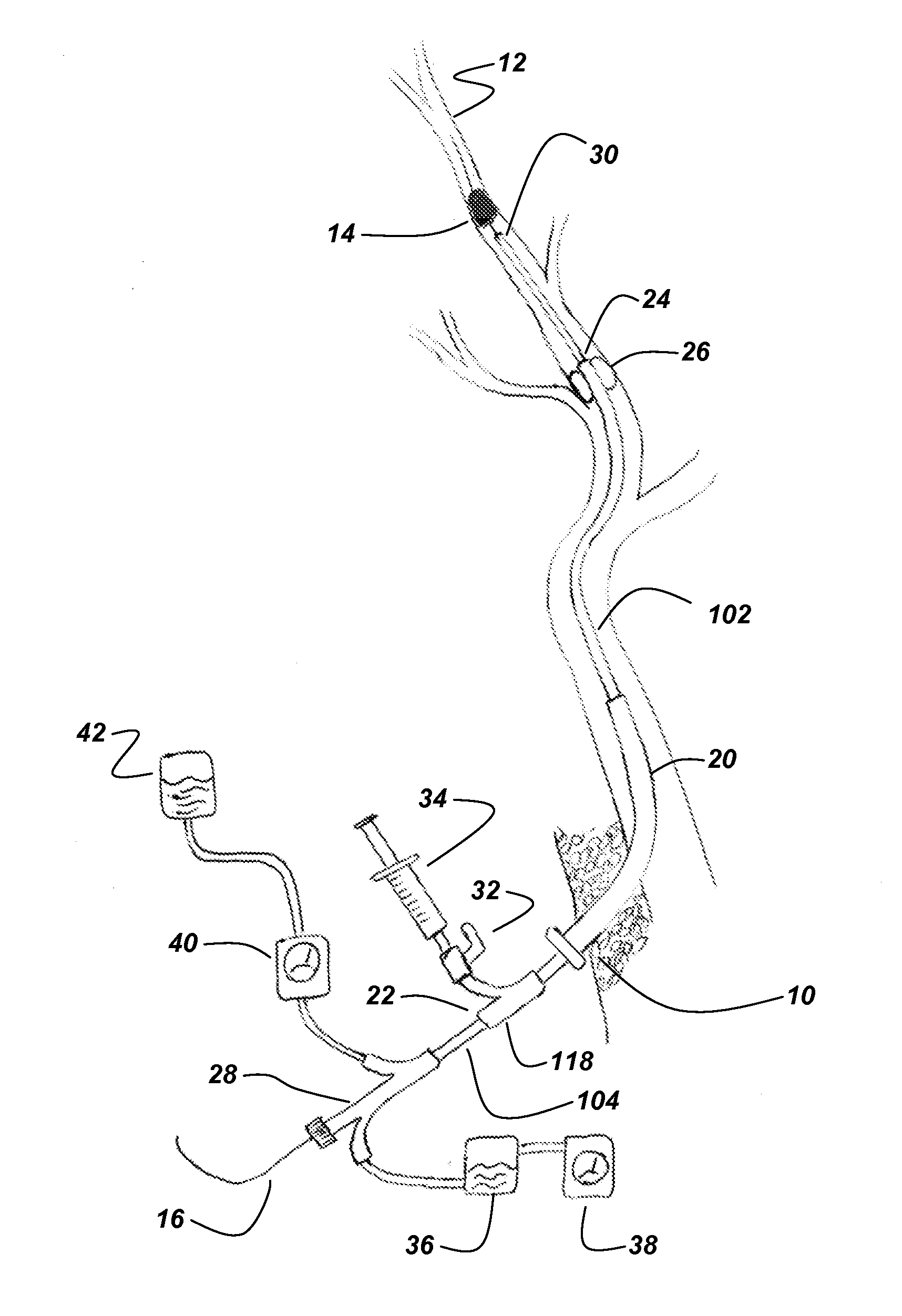 Neurovascular microcatheter device, system and methods for use thereof