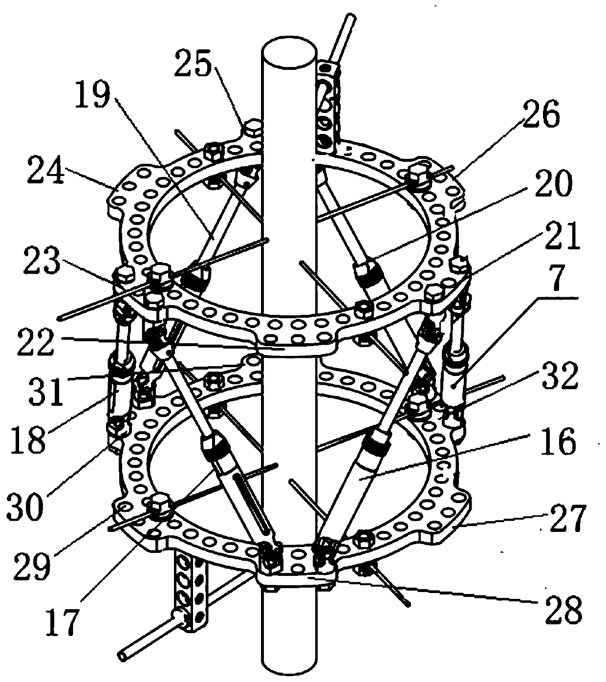 Taylor external fixing stent