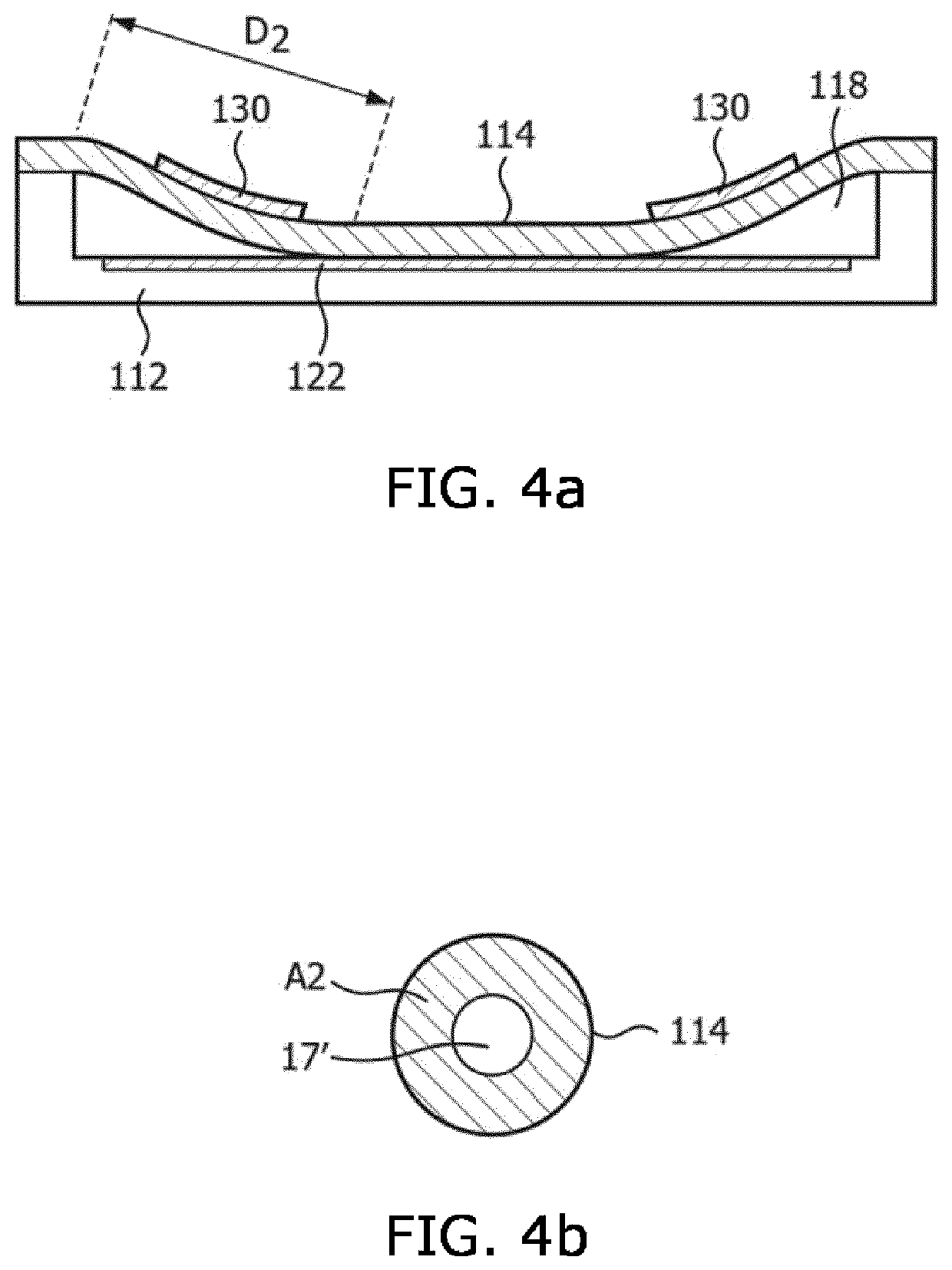 Ultrasound system and method