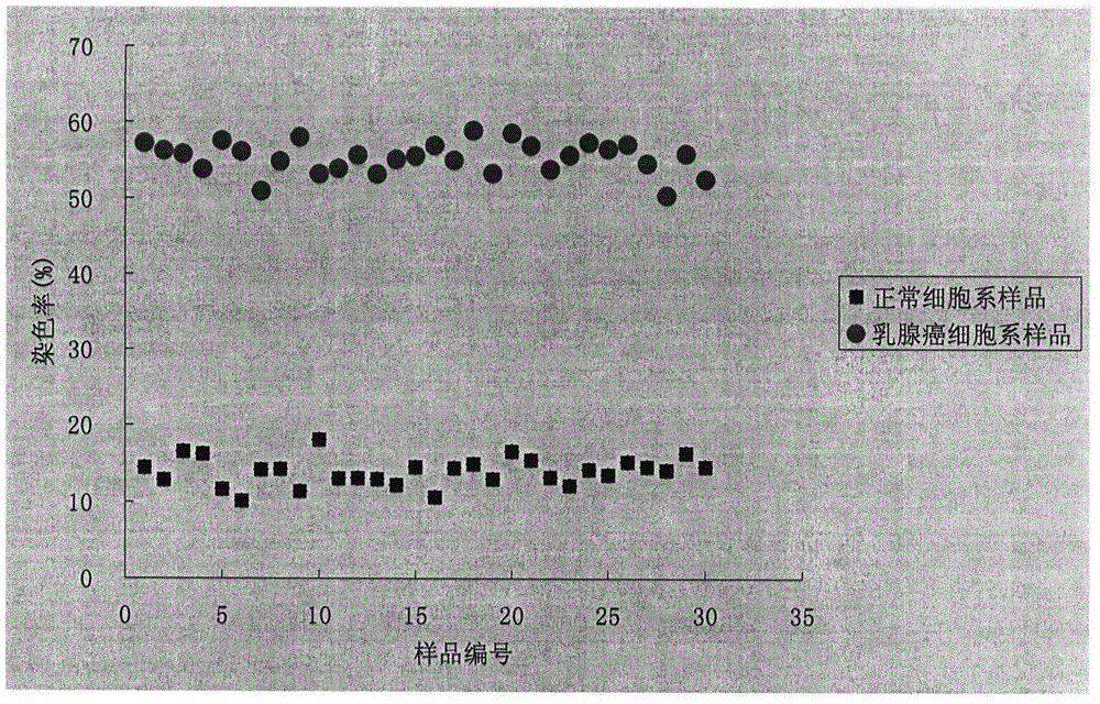 System for detecting breast cancer