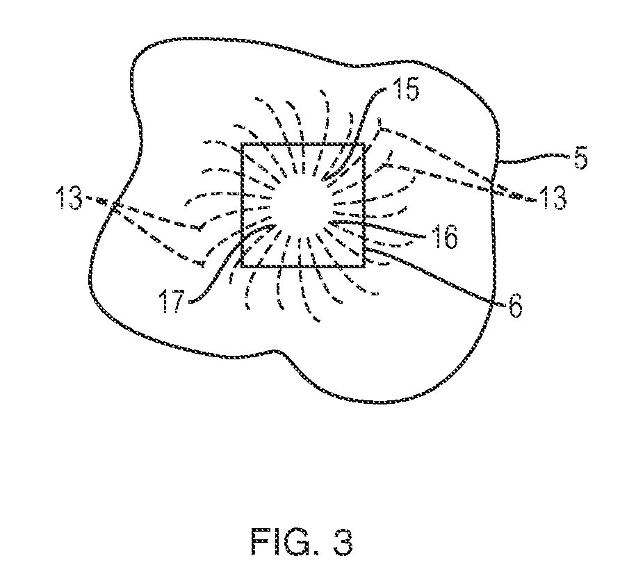 Apparatus and method for controlled fluid cooling during laser based dental treatments