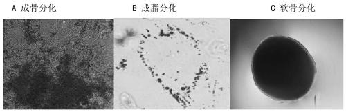 A kind of preparation method of clinical grade placental mesenchymal stem cells