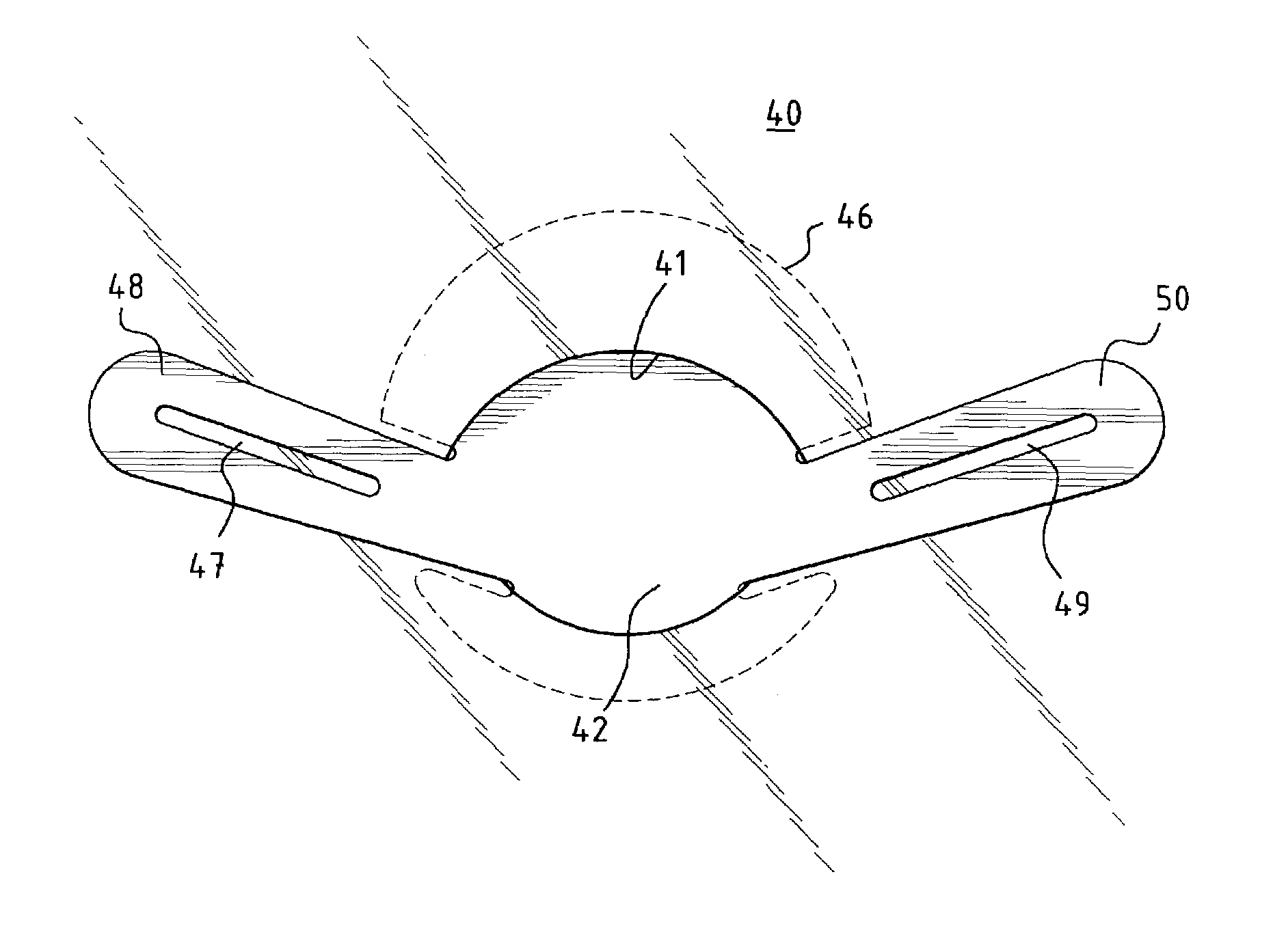 One-piece minicapsulorhexis valve