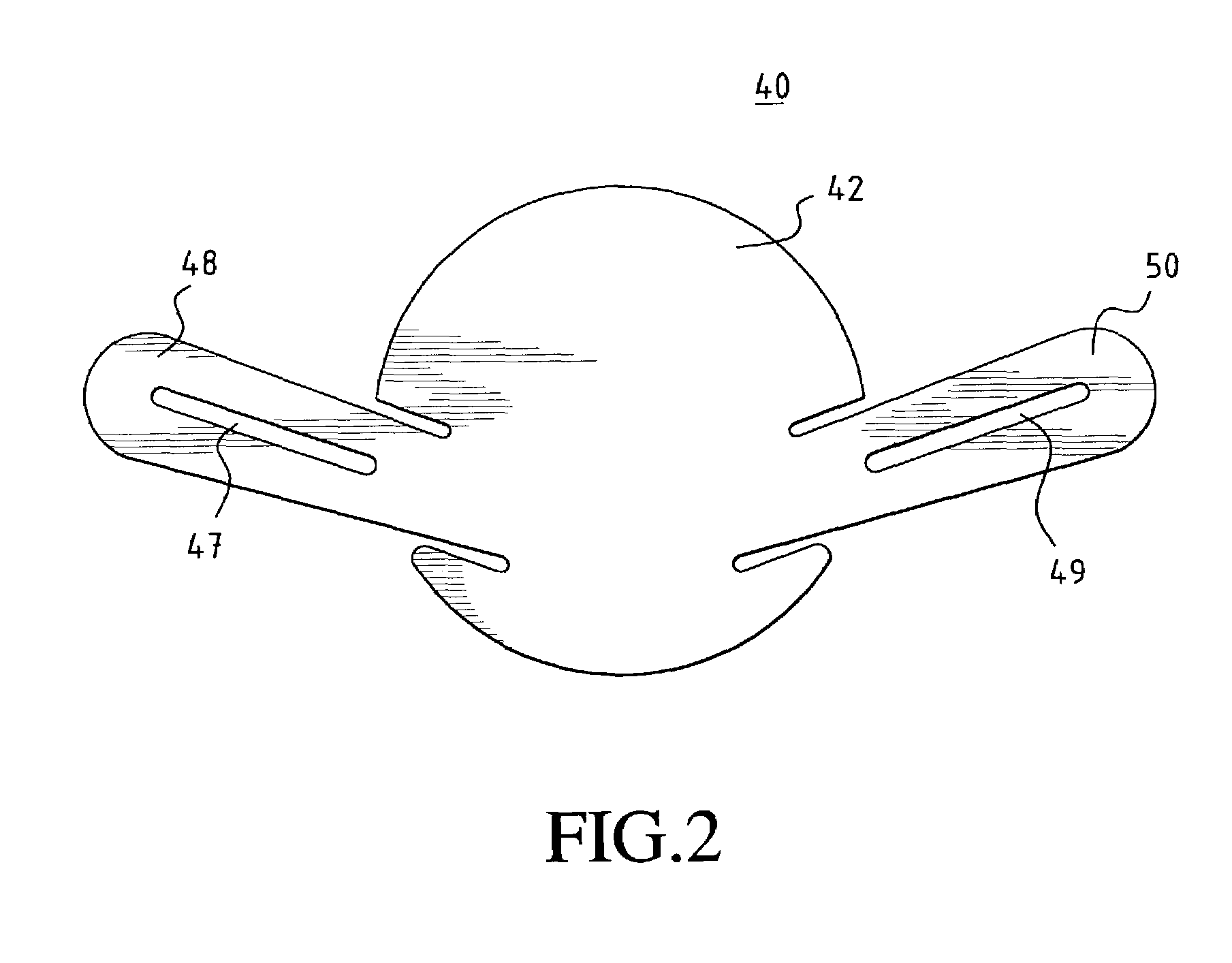 One-piece minicapsulorhexis valve