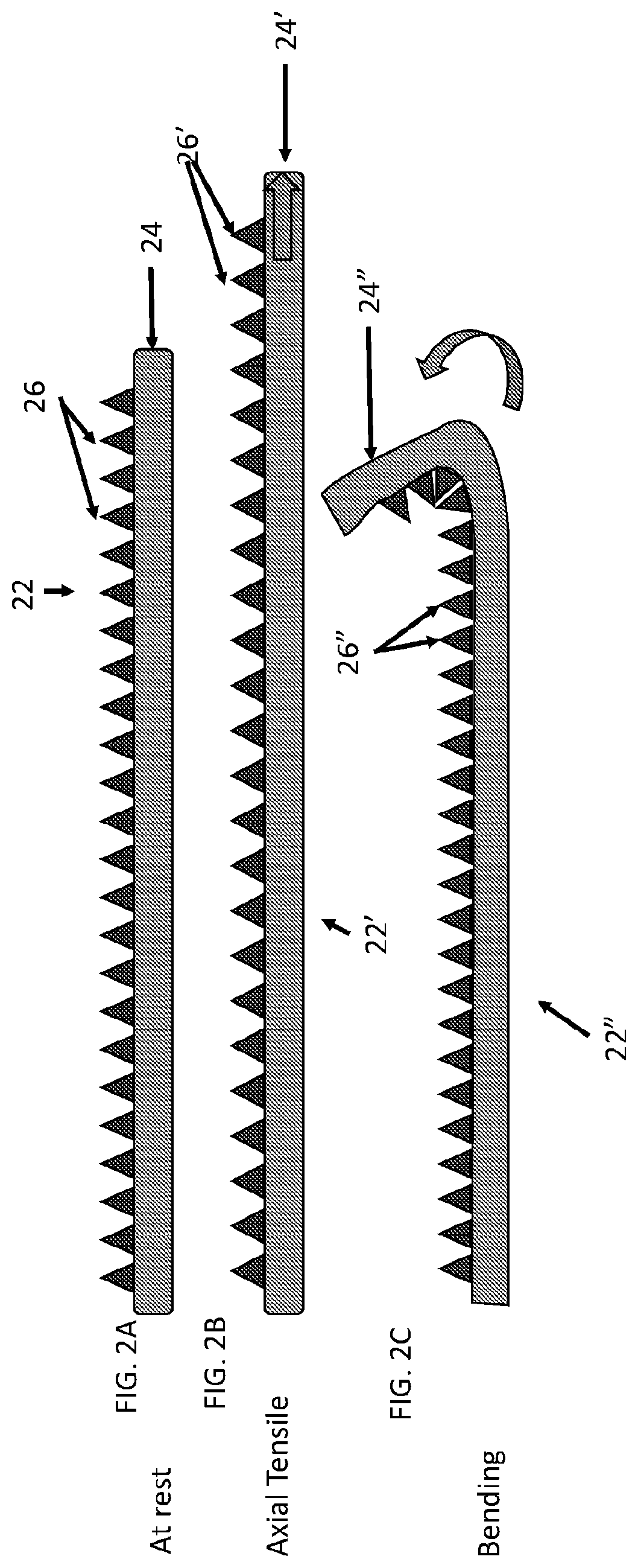 Surgical repair graft