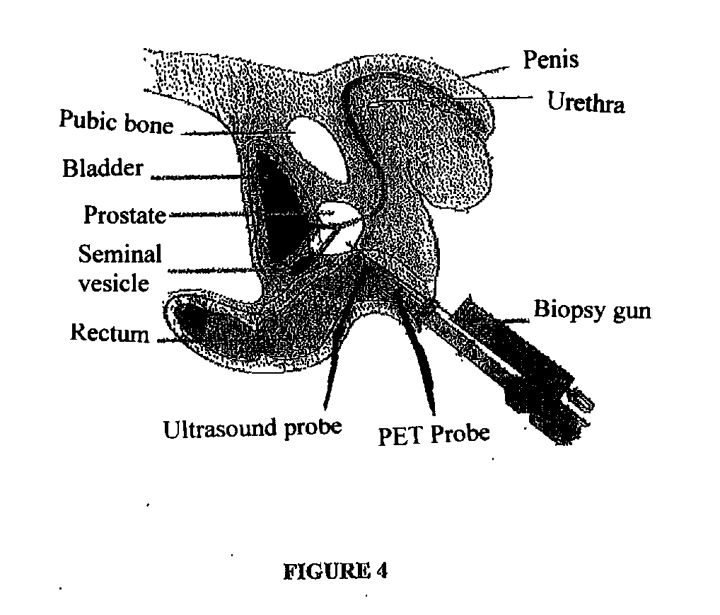 Endorectal Prostate Probe With Combined PET and US Modalities