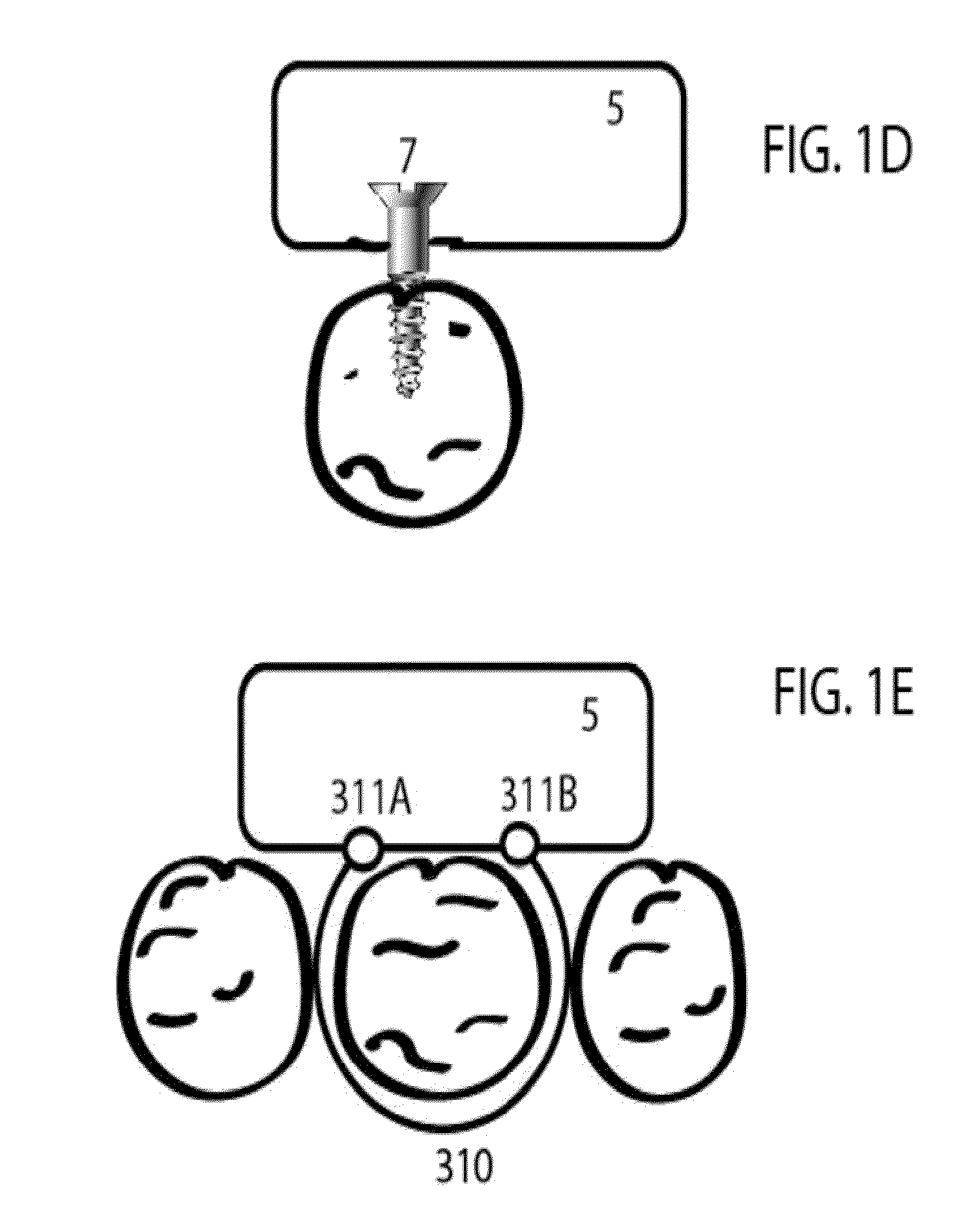 Intra-oral brackets for transmitting vibrations