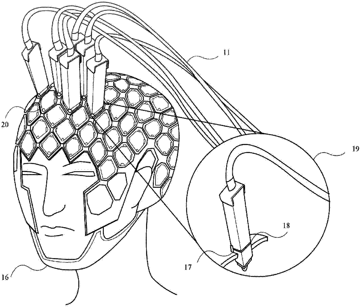 MEG device and method based on atomic magnetometer/magnetic gradiometer