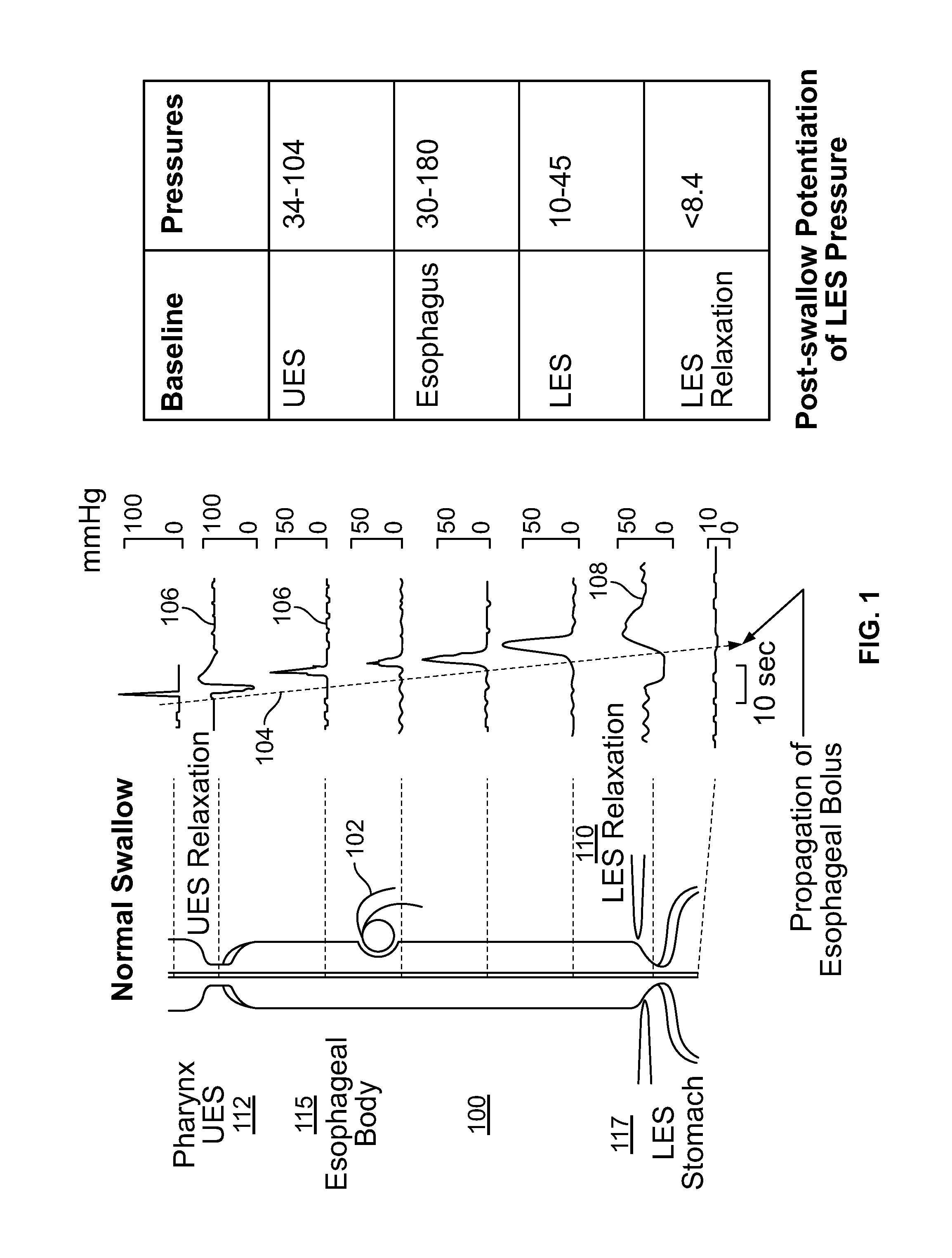 Device and Implantation System for Electrical Stimulation of Biological Systems