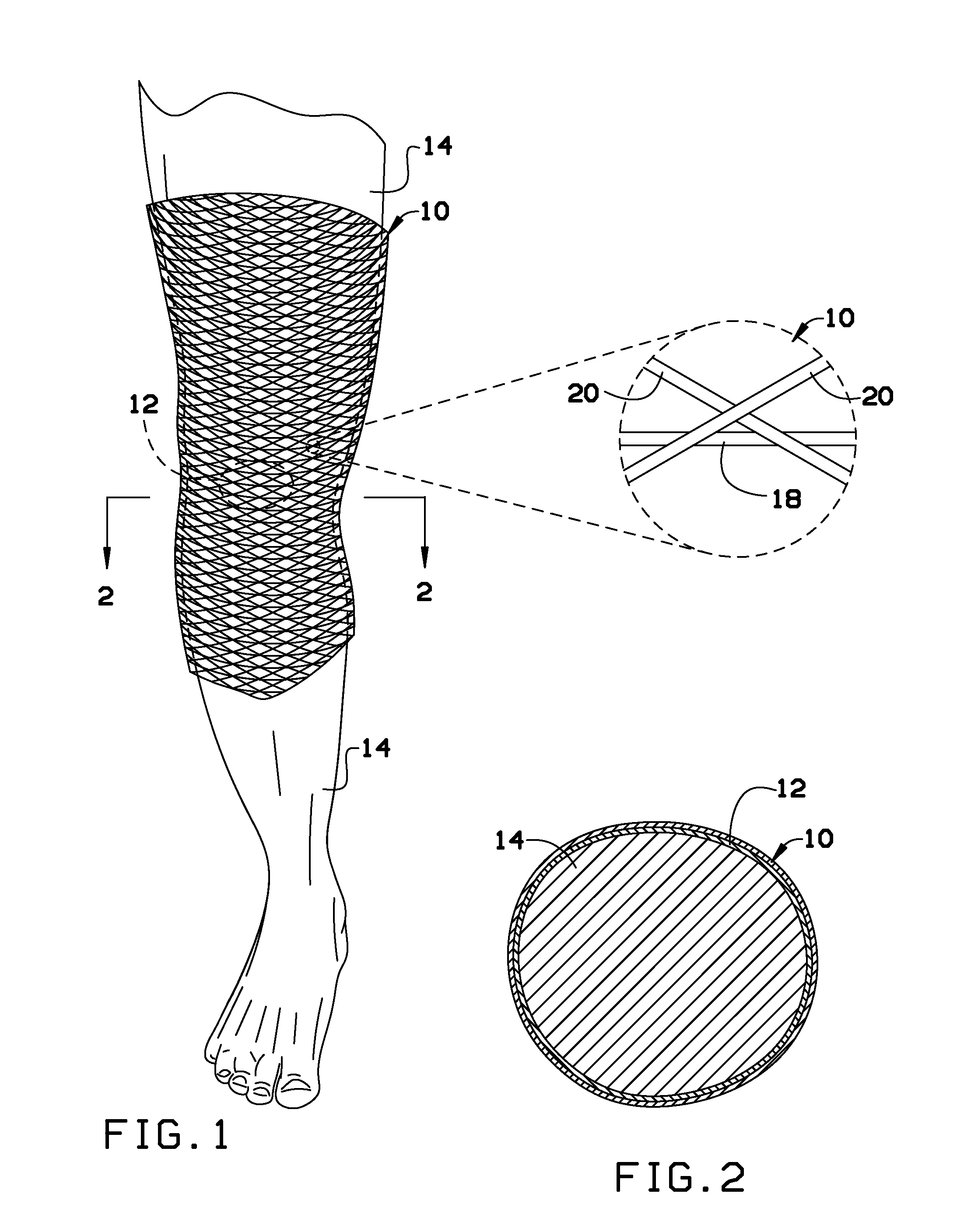 Joint support device