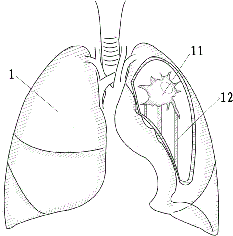 Tumor-reductive surgery exercise model and manufacturing method thereof