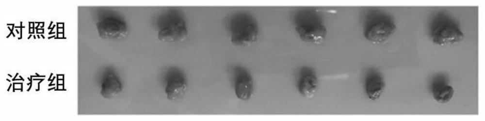 Novel use of a pharmaceutical composition comprising n-valeric acid, indole propionic acid and sodium n-butyrate