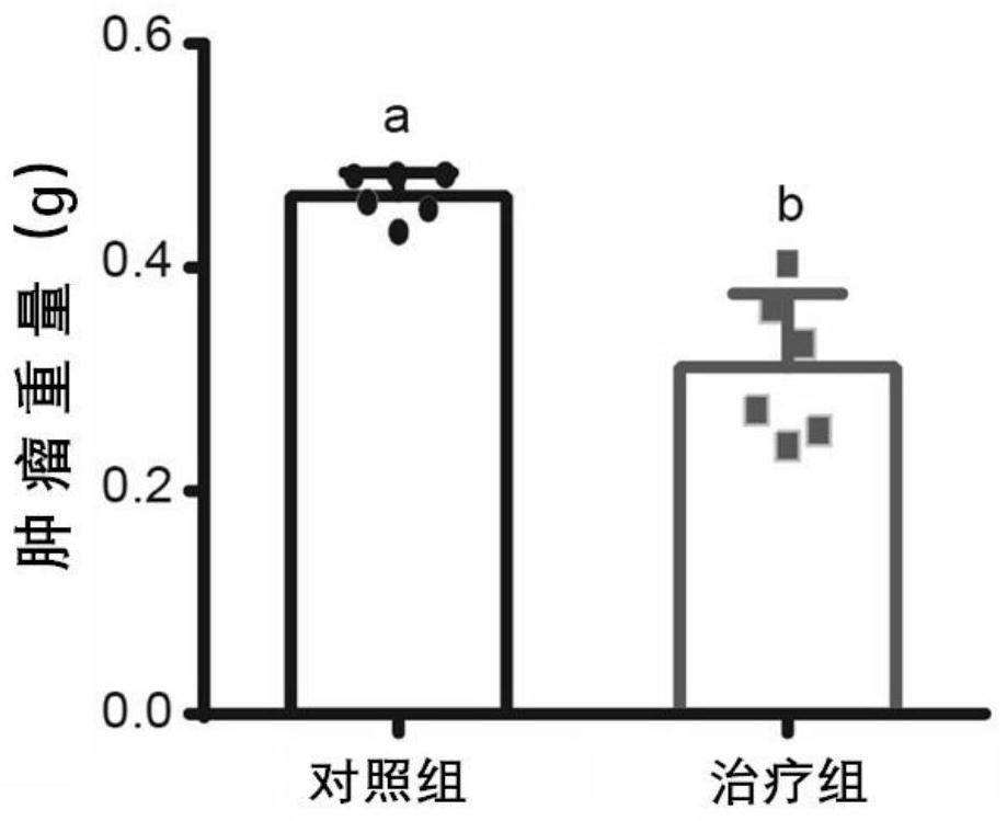 Novel use of a pharmaceutical composition comprising n-valeric acid, indole propionic acid and sodium n-butyrate